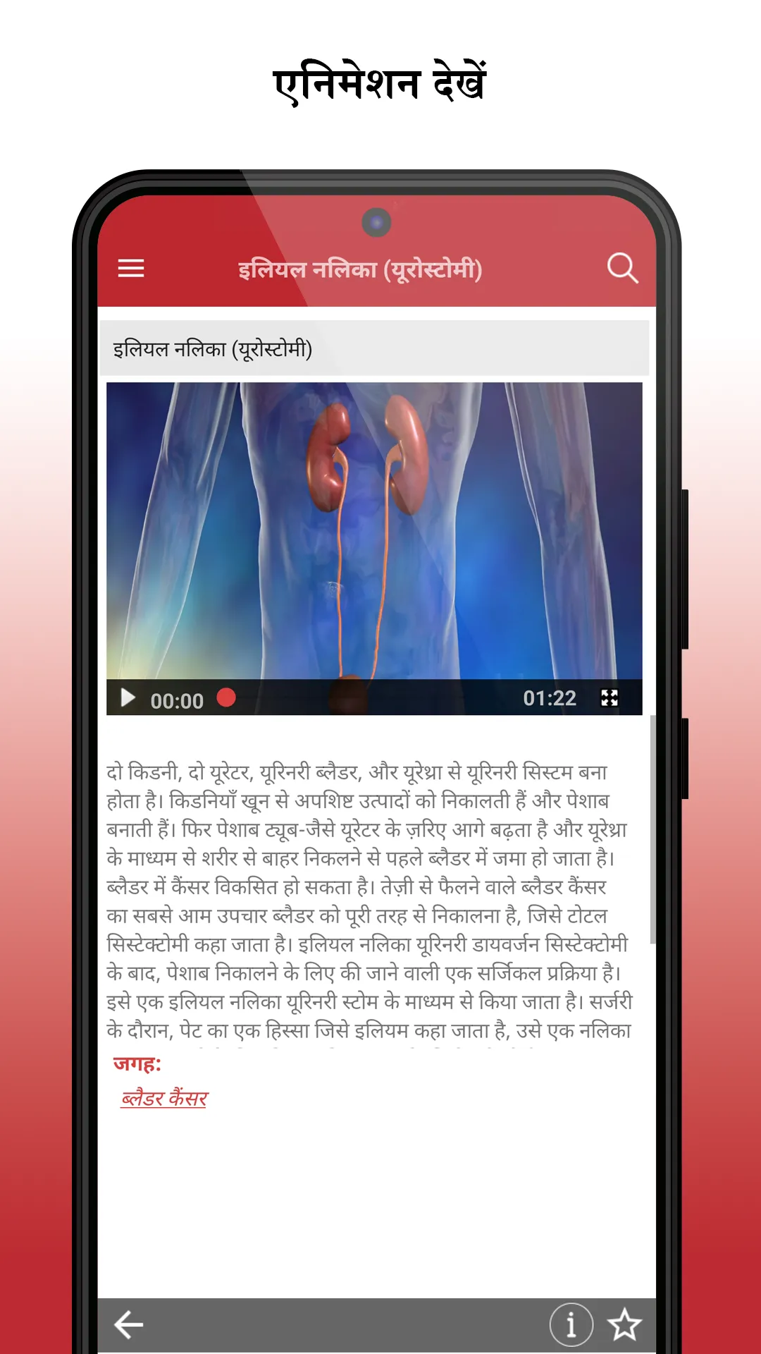 MSD मैनुअल उपभोक्ता संस्करण | Indus Appstore | Screenshot