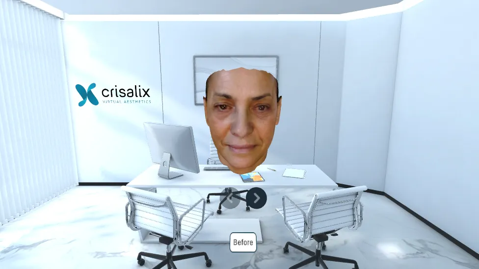 Crisalix VR | Indus Appstore | Screenshot