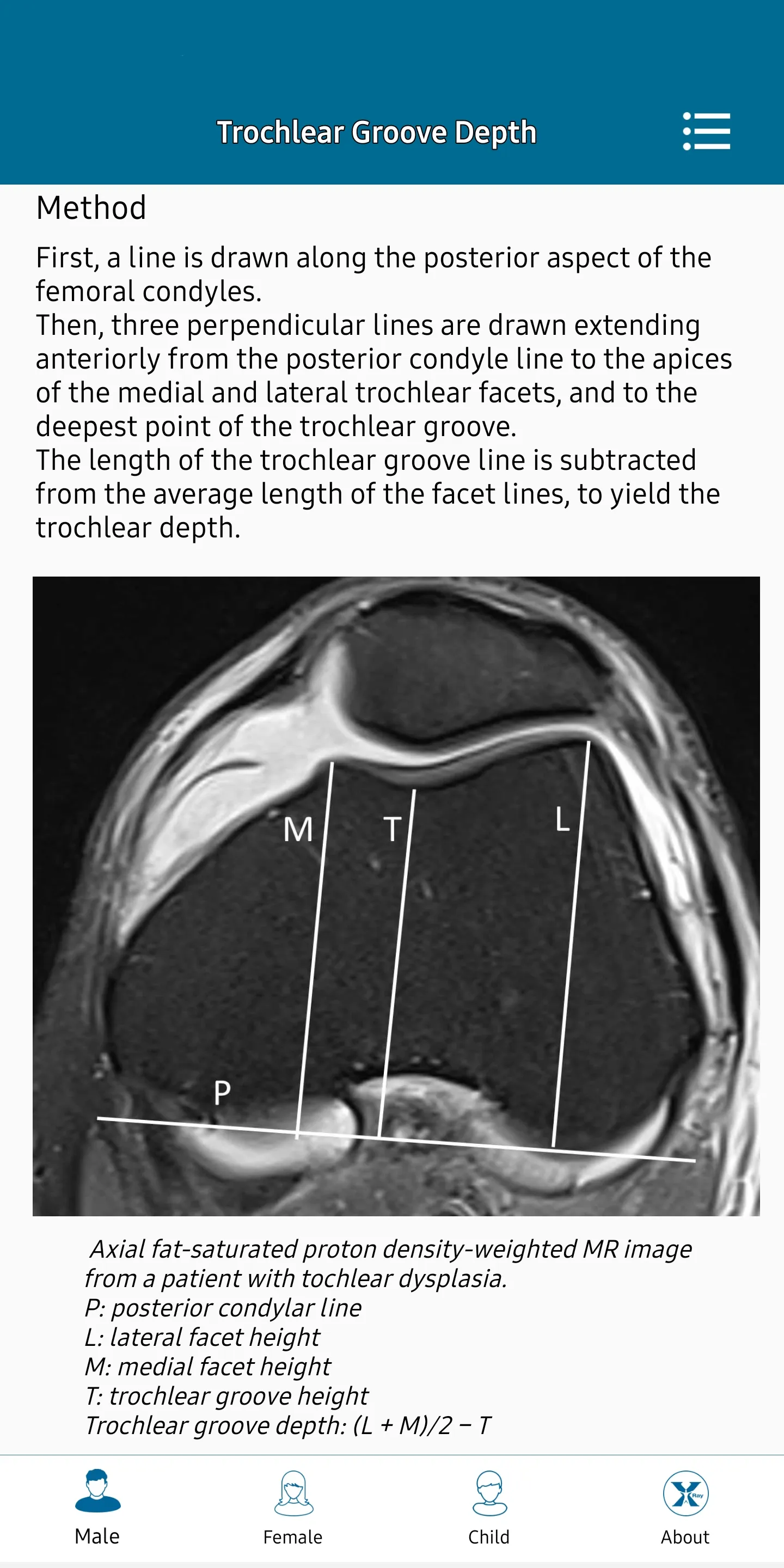 Radiology Measurements | Indus Appstore | Screenshot