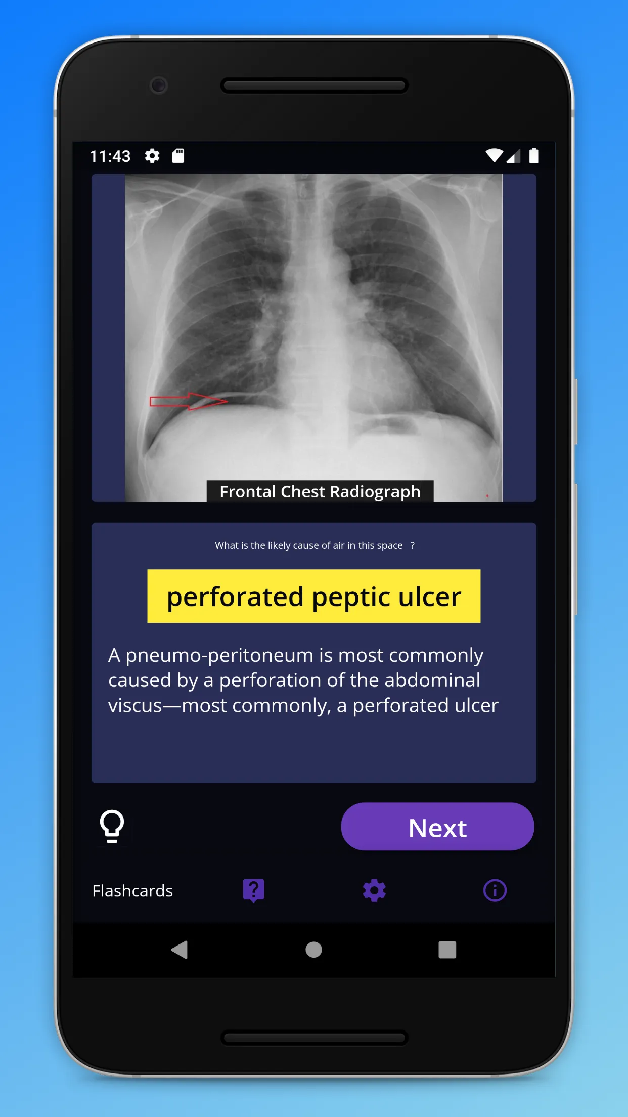 Basic Radiology | Indus Appstore | Screenshot