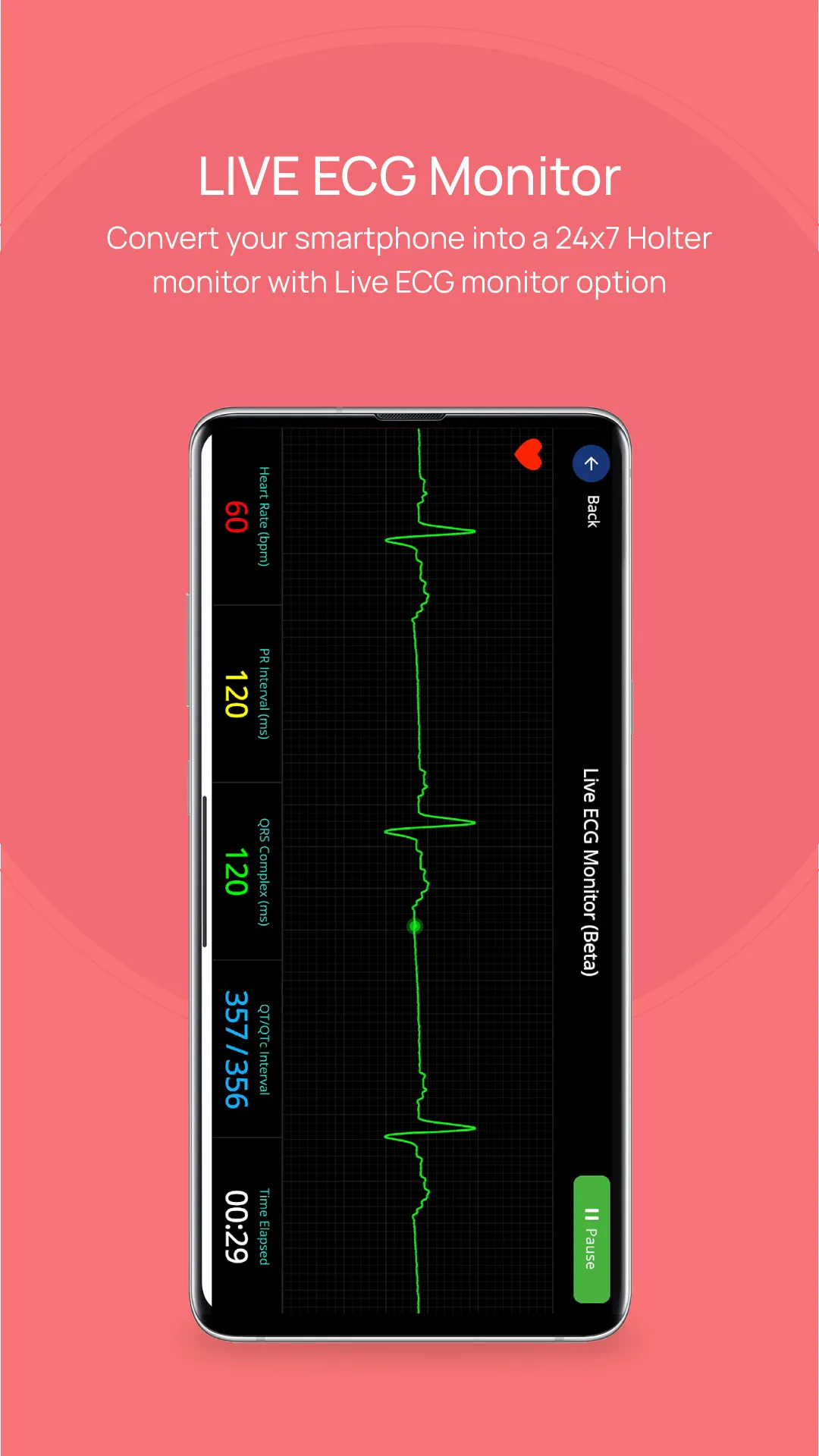 Spandan-ECG/EKG on smartphone | Indus Appstore | Screenshot