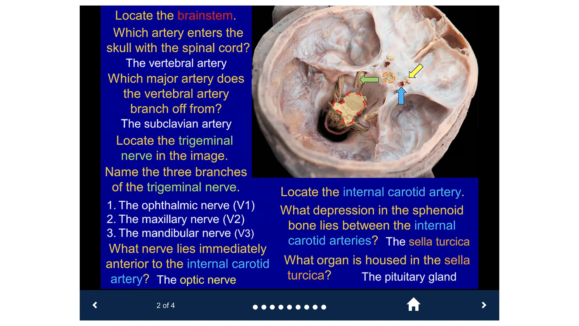 Head & Neck Anatomy-SecondLook | Indus Appstore | Screenshot