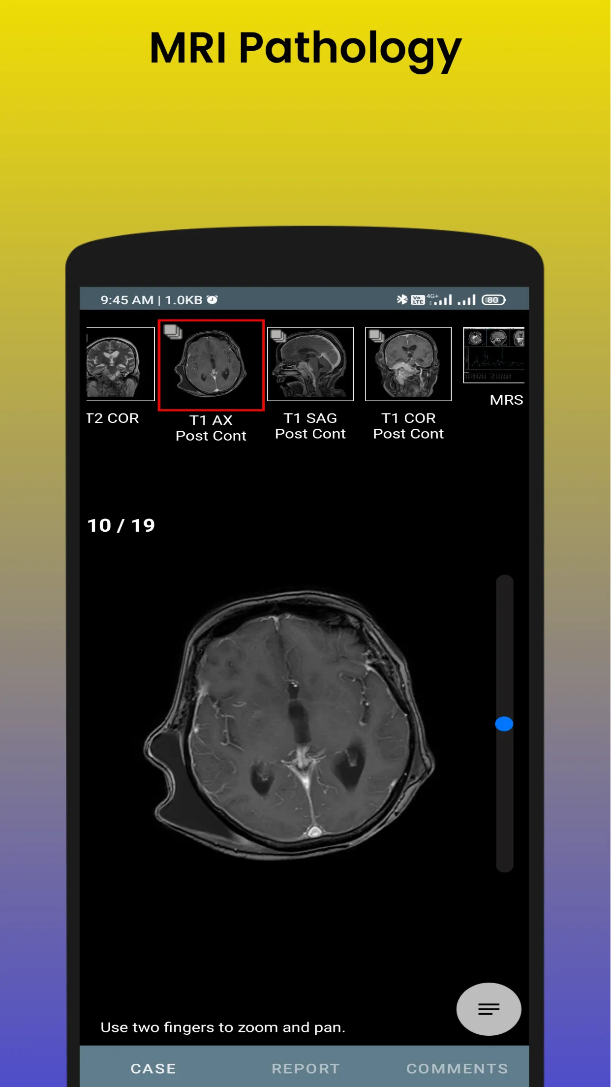 Master in MRI | MRI Scan | Indus Appstore | Screenshot