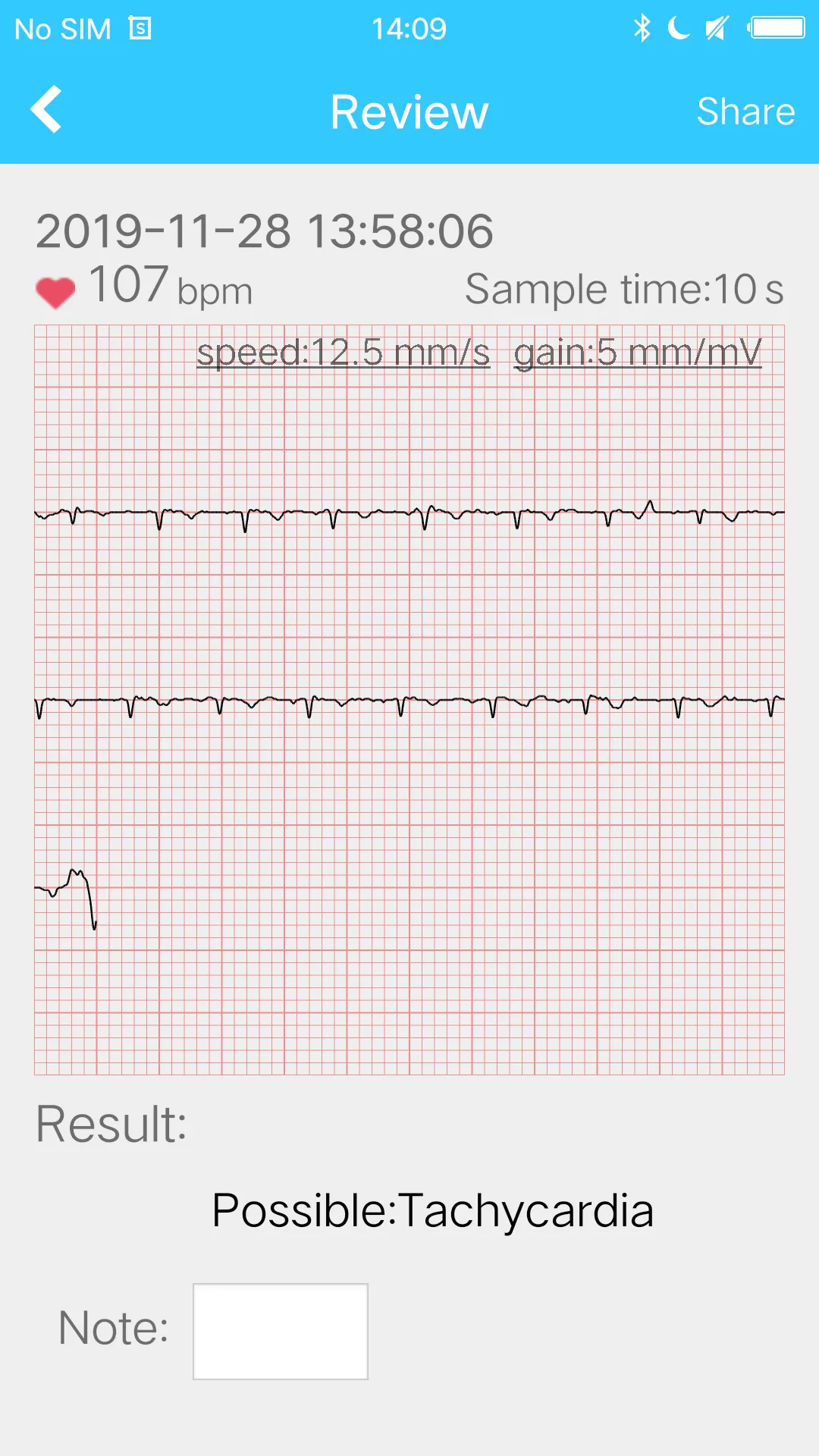 Mini ECG Aide | Indus Appstore | Screenshot