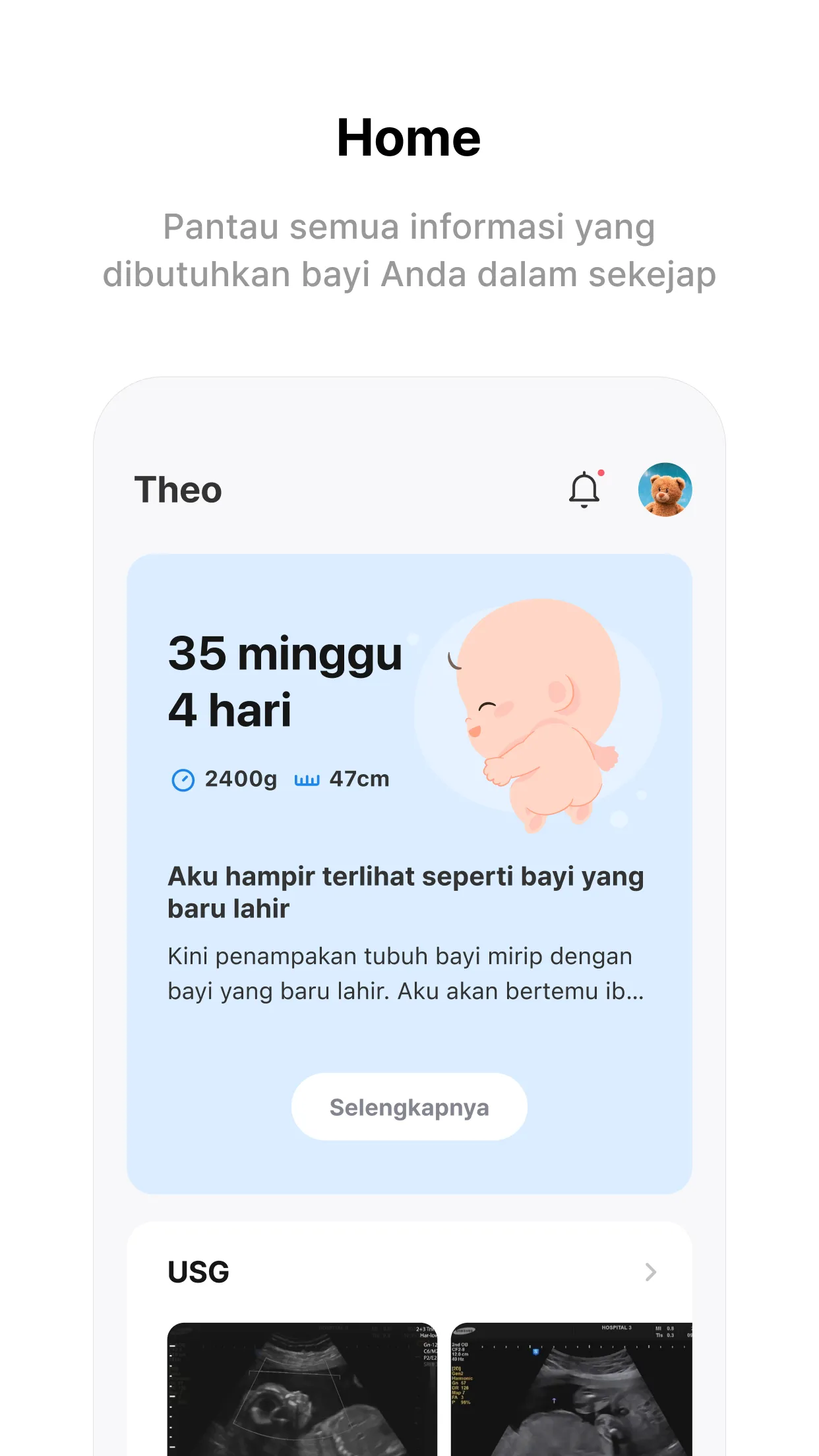 Momitalk: Pregnancy Ultrasound | Indus Appstore | Screenshot