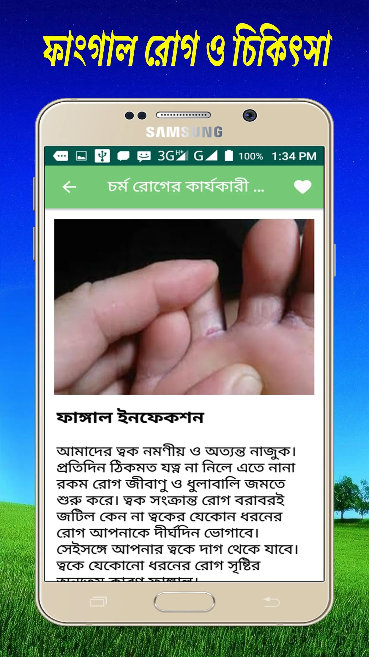 চর্ম রোগের কারণ  ও  চিকিৎসা | Indus Appstore | Screenshot