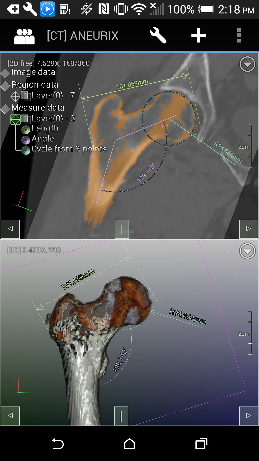 DroidRender - 3D DICOM viewer | Indus Appstore | Screenshot