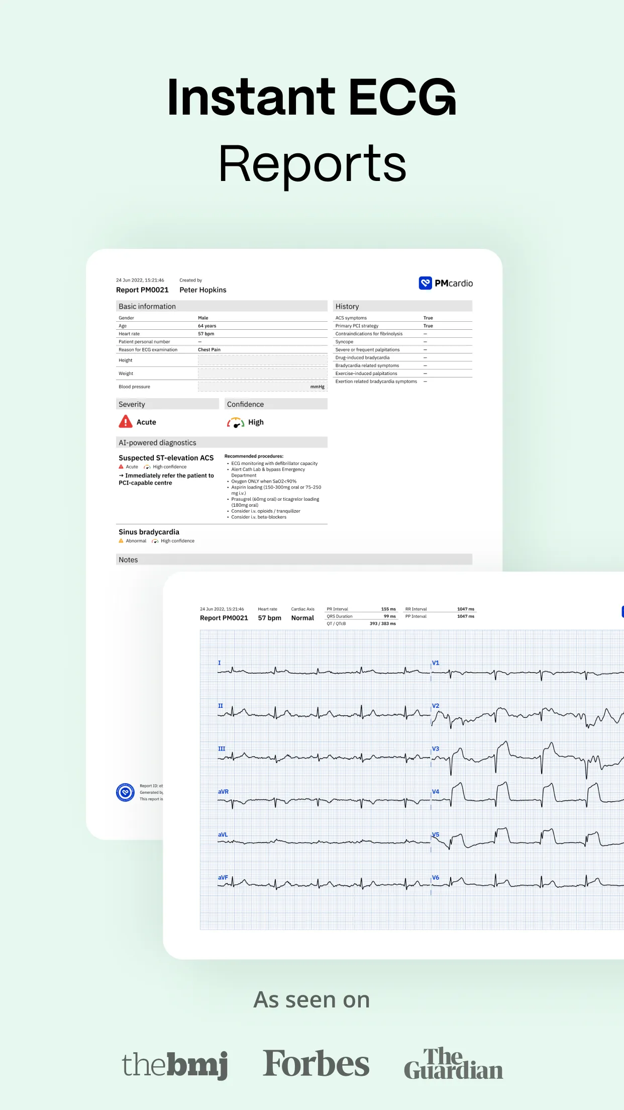 PMcardio - ECG Analysis | Indus Appstore | Screenshot