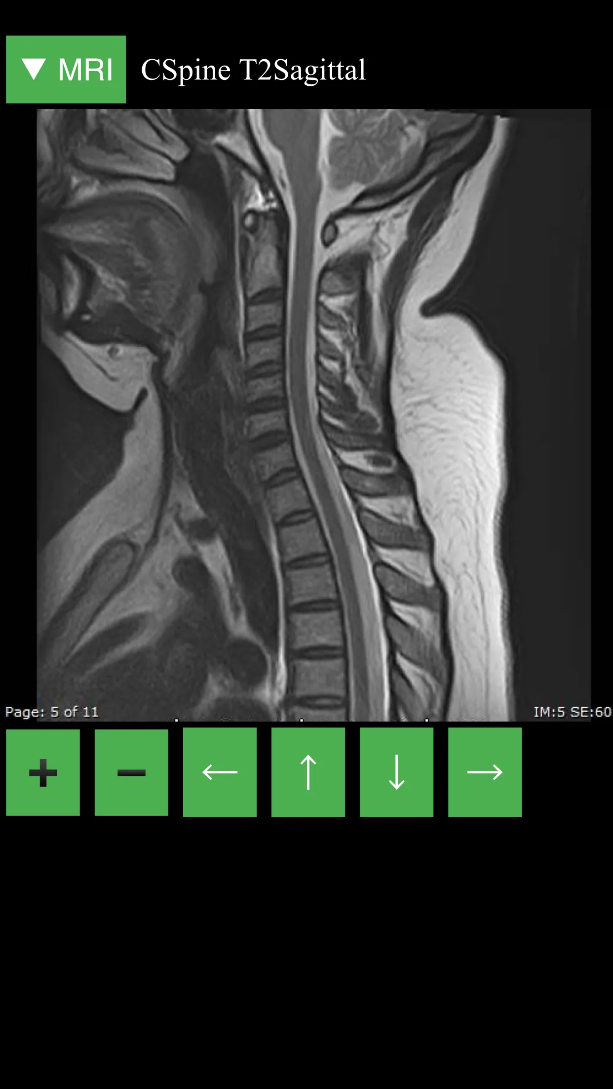 MRI Viewer | Indus Appstore | Screenshot