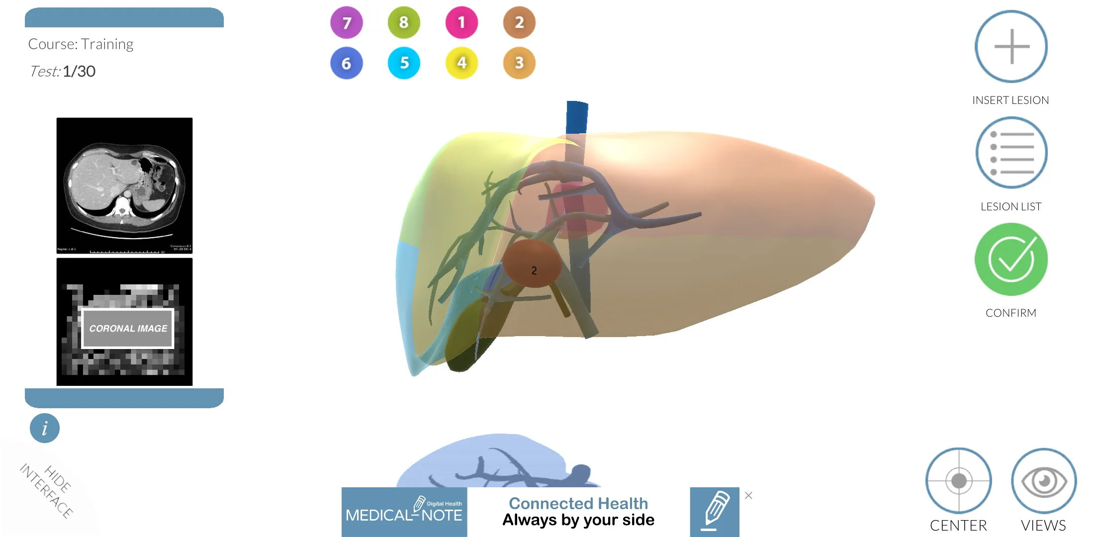 LIVER-NOTE.Edu | Indus Appstore | Screenshot