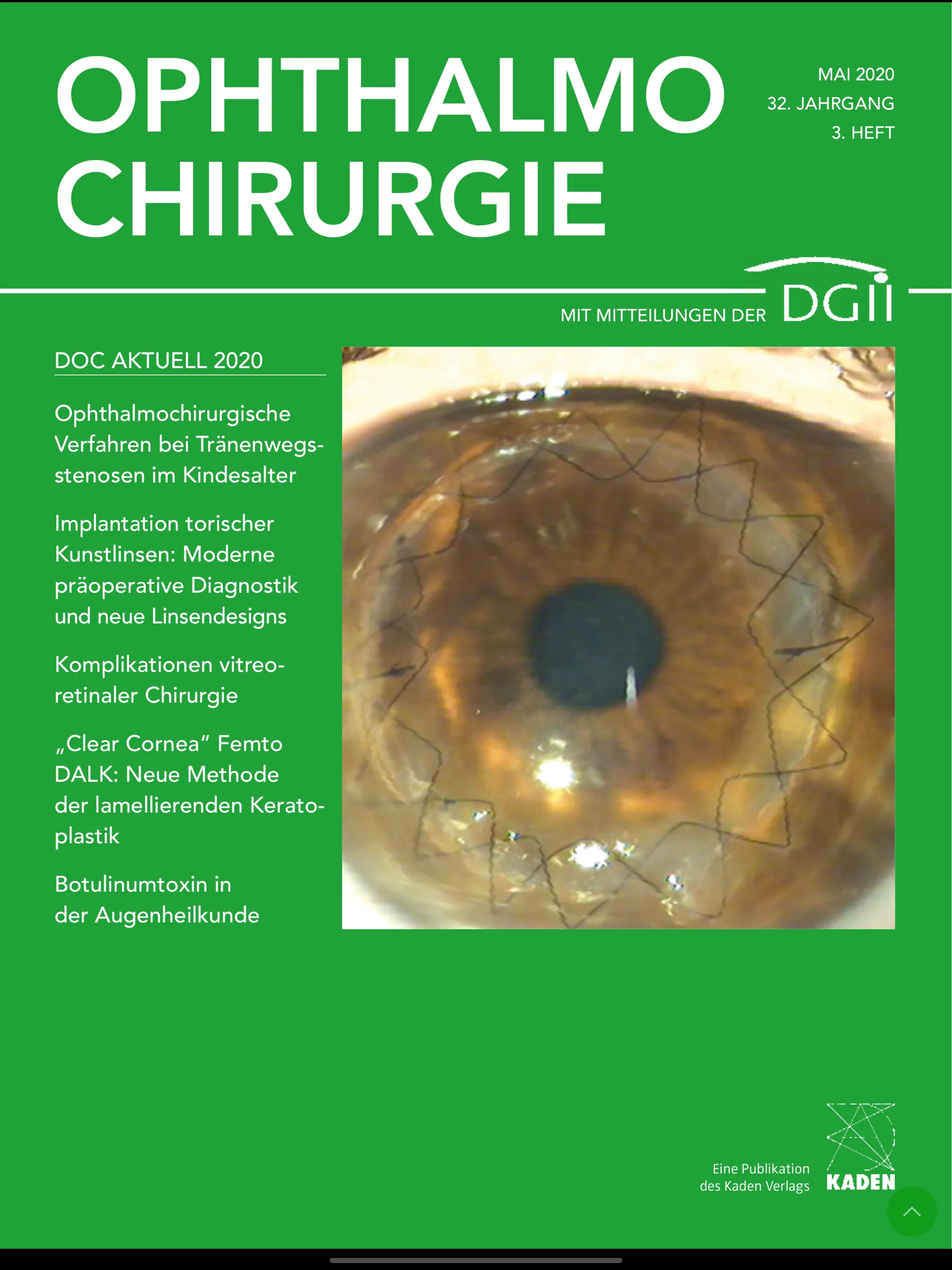 OPHTHALMO-CHIRURGIE – OC App | Indus Appstore | Screenshot