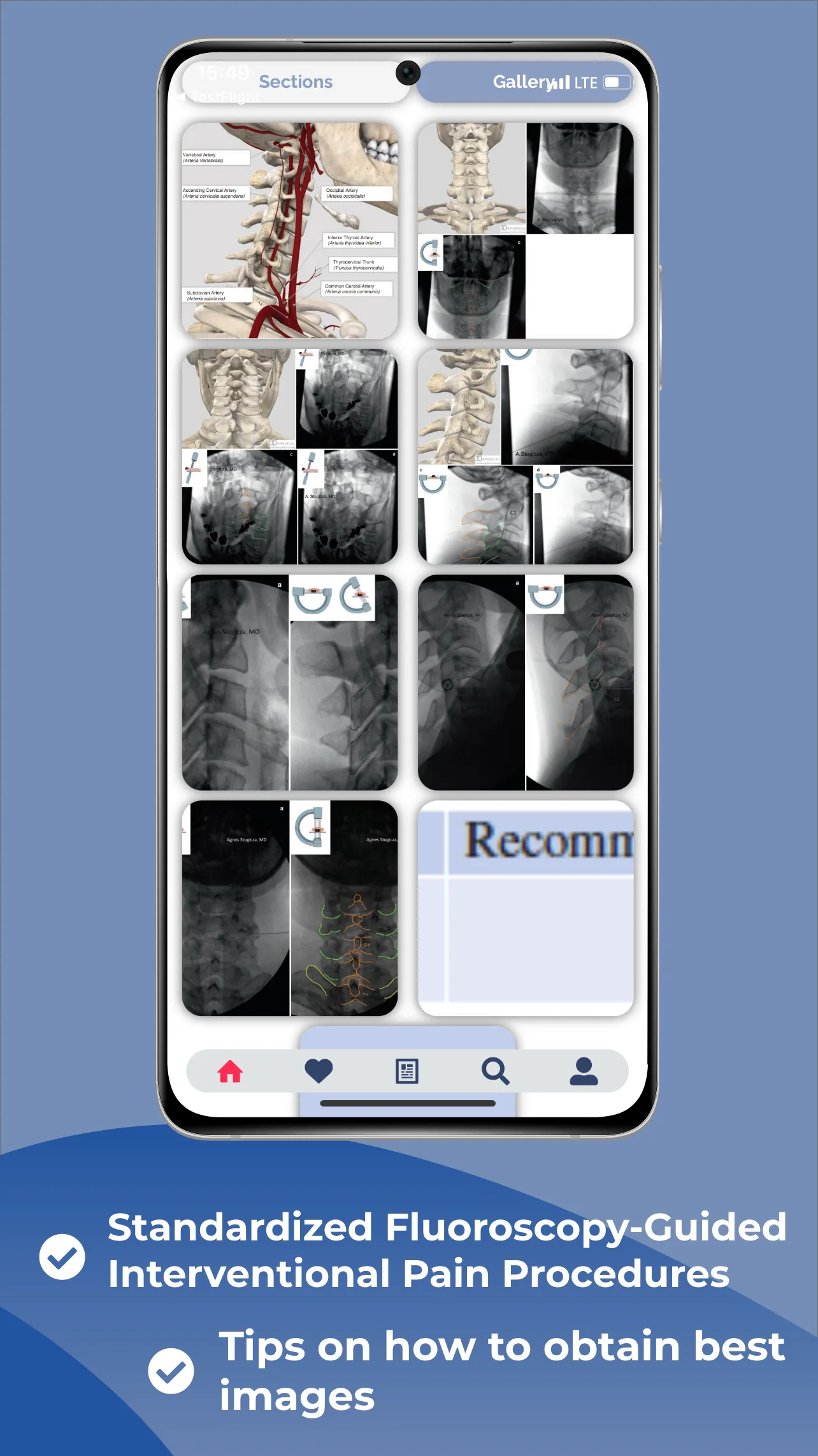 Interventional Pain App | Indus Appstore | Screenshot