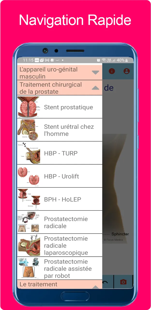 Atlas d'urologie | Indus Appstore | Screenshot