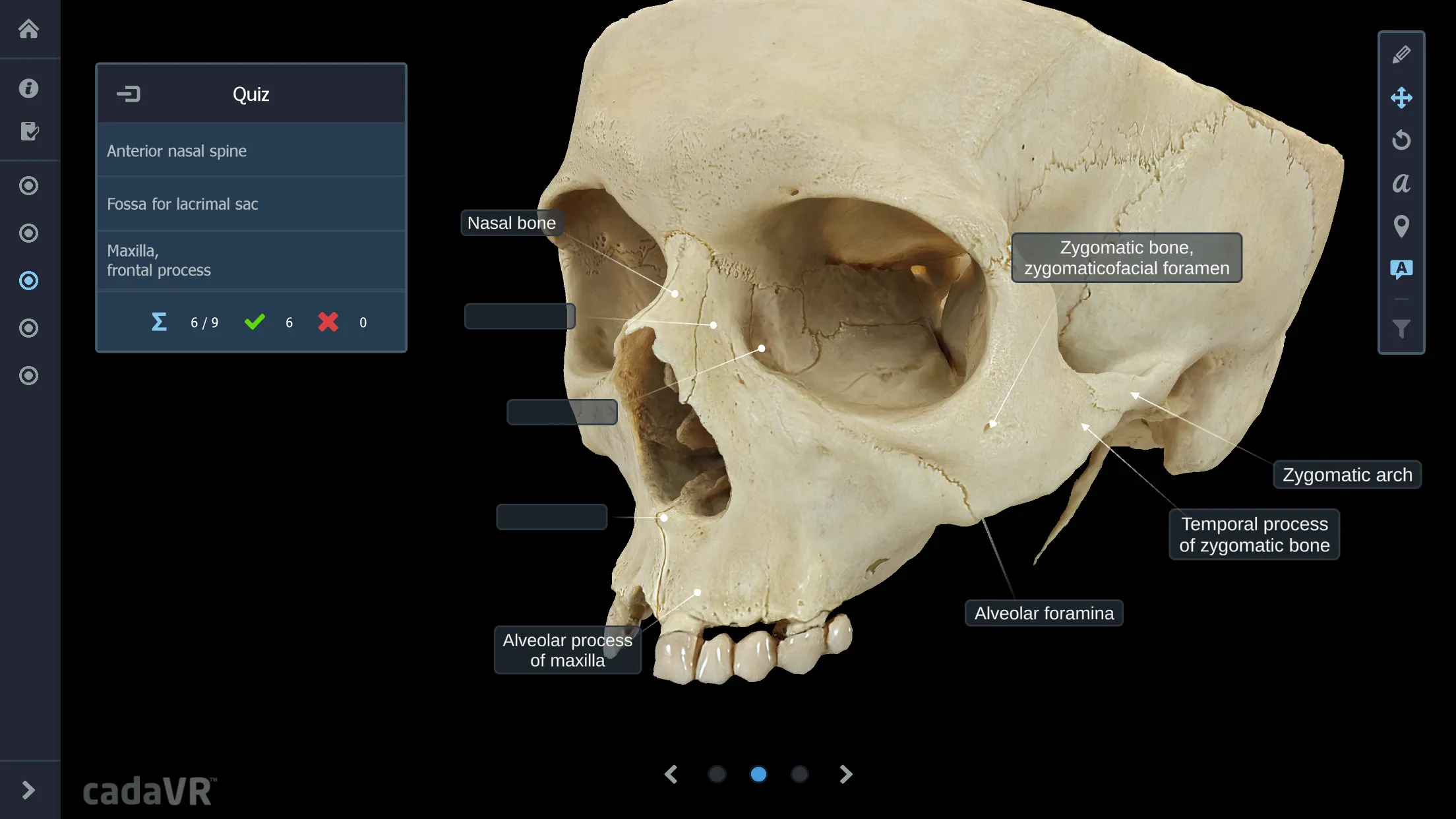 cadaVR anatomy | Indus Appstore | Screenshot