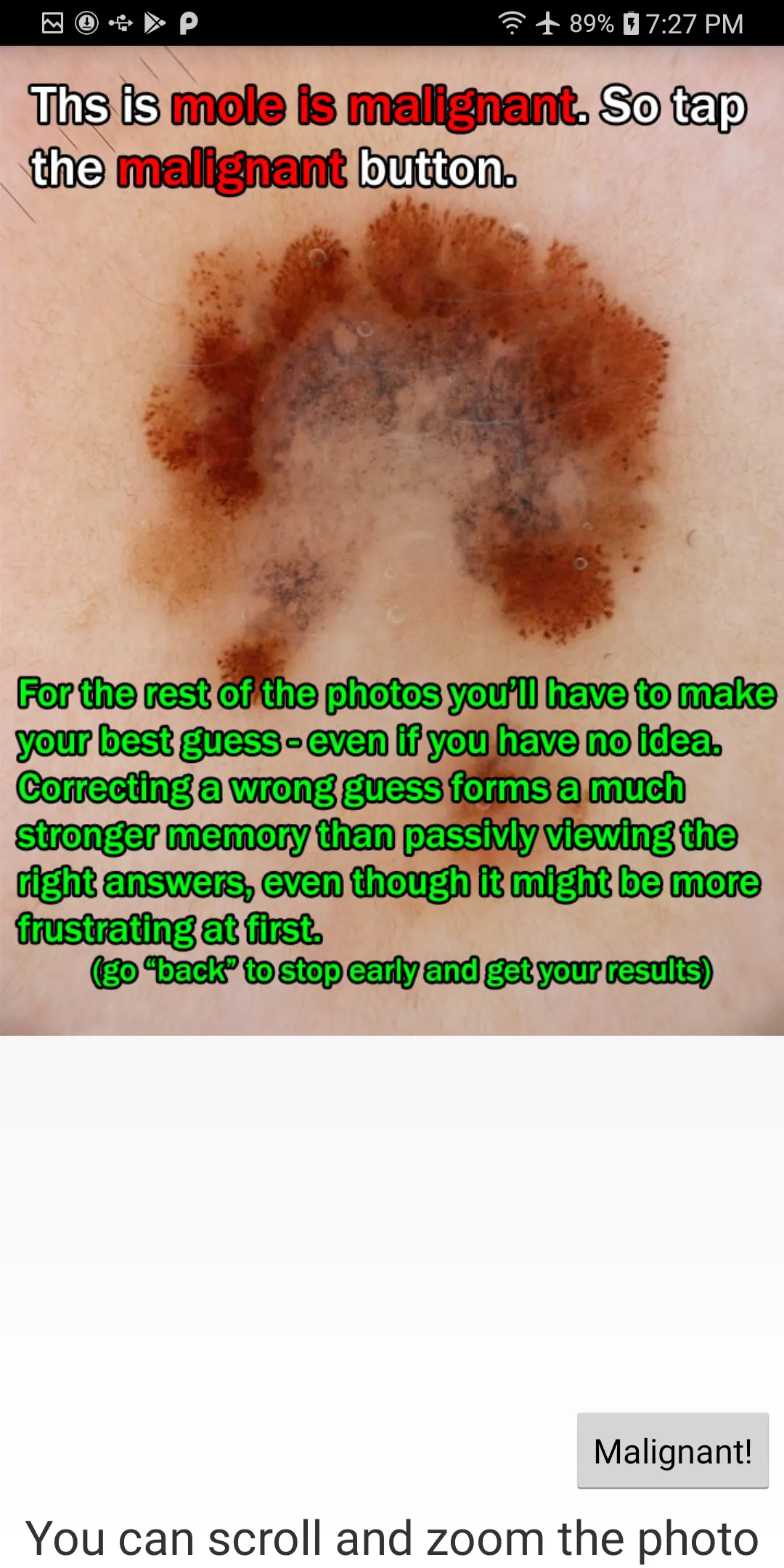 Skin Cancer Flashcard "game" | Indus Appstore | Screenshot