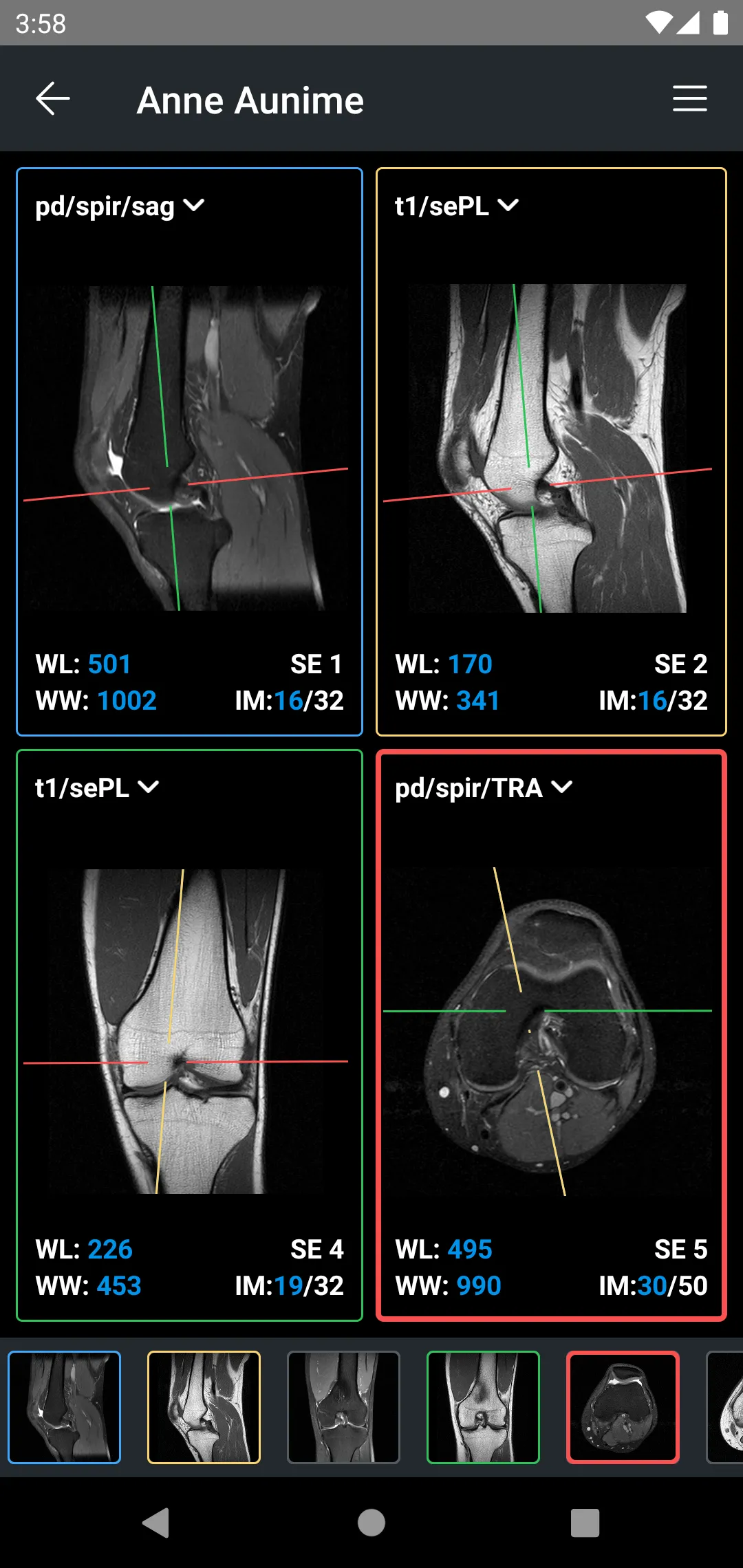 IDV - IMAIOS DICOM Viewer | Indus Appstore | Screenshot