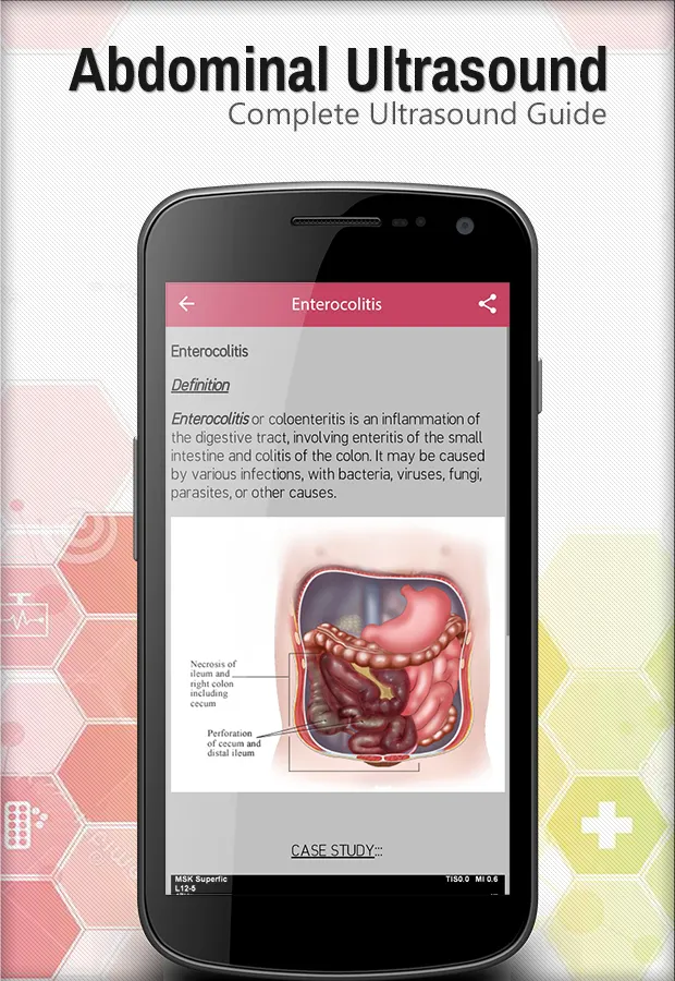 Abdominal Ultrasound Guide | Indus Appstore | Screenshot