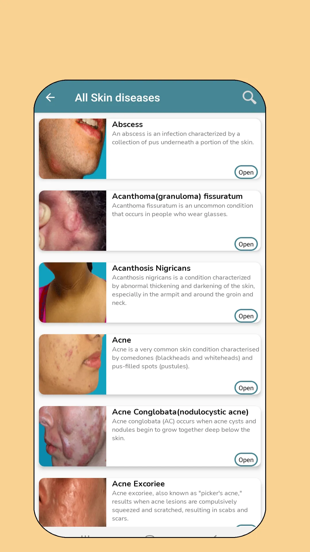 Skin diseases and treatment | Indus Appstore | Screenshot