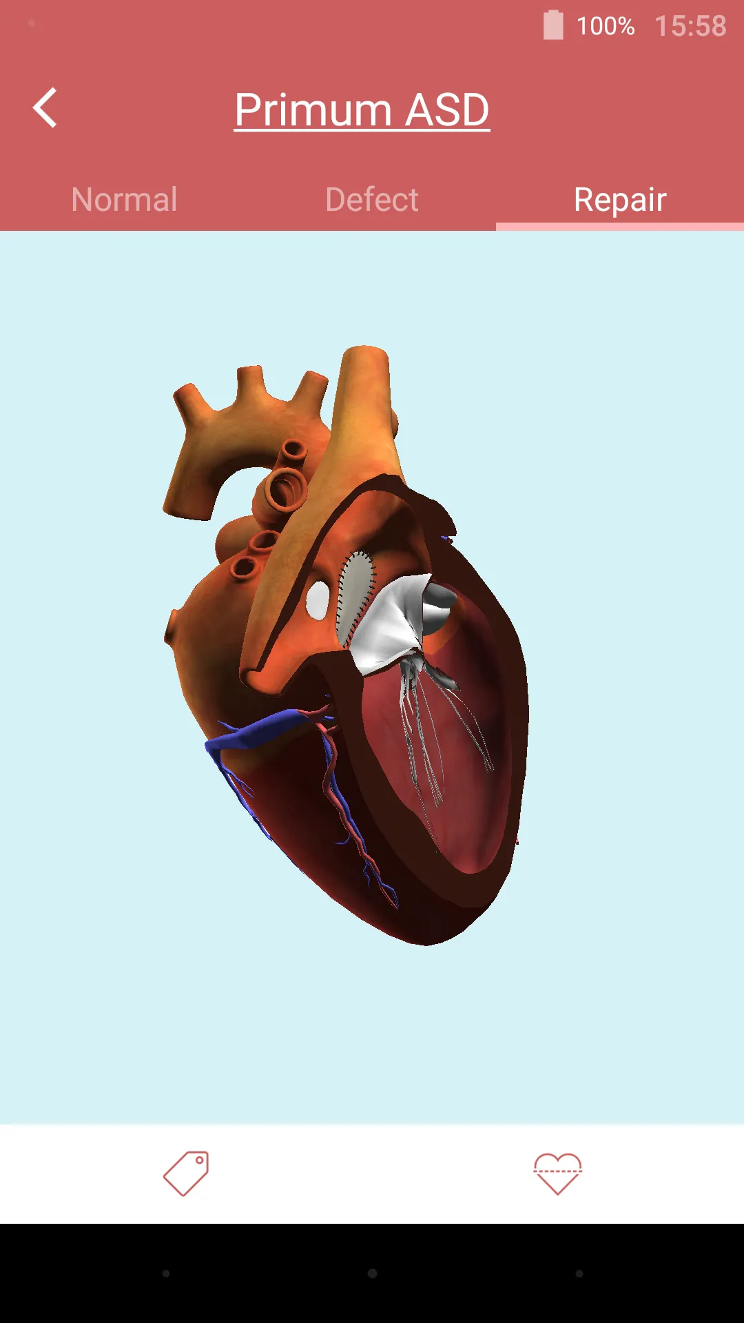 eMurmur Heartpedia | Indus Appstore | Screenshot