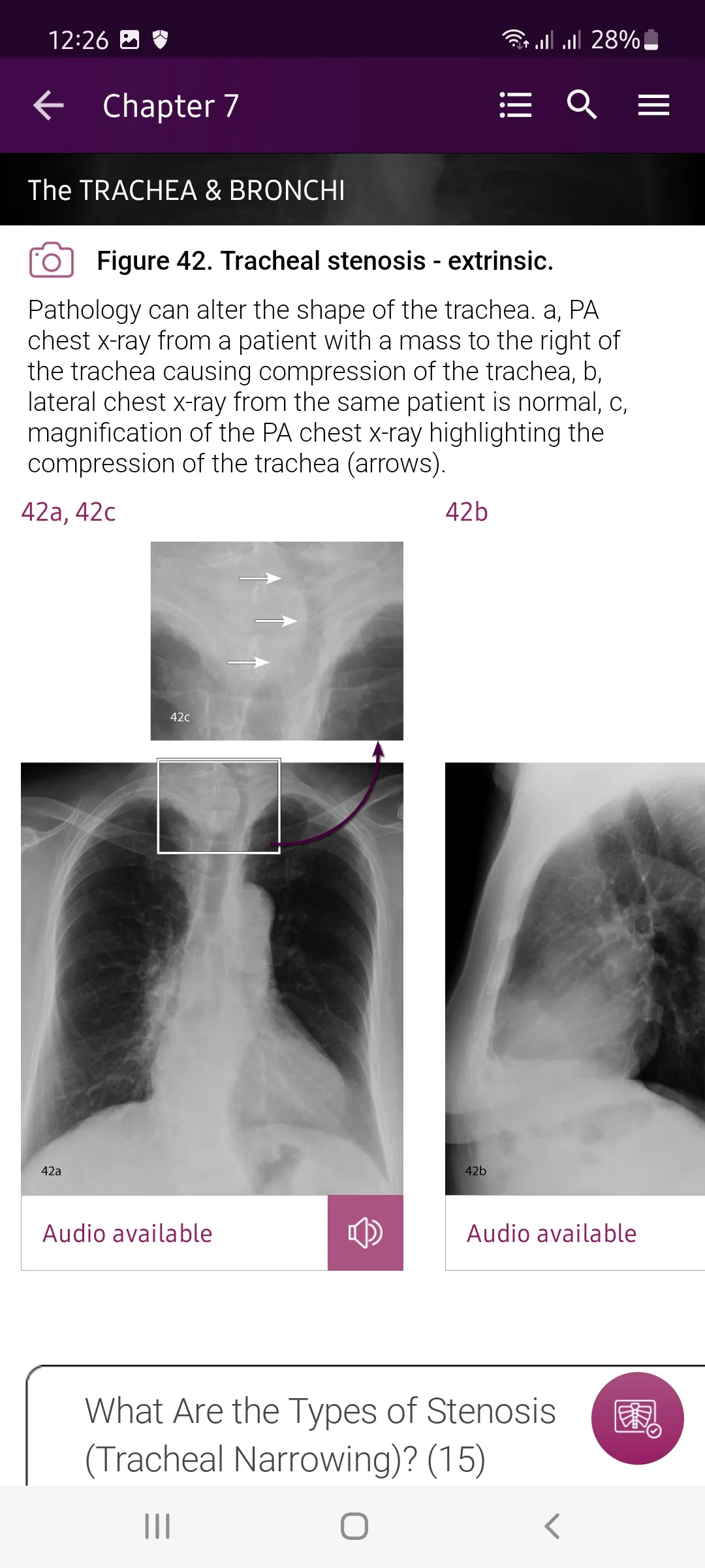 Chest X-Ray DEMO | Indus Appstore | Screenshot