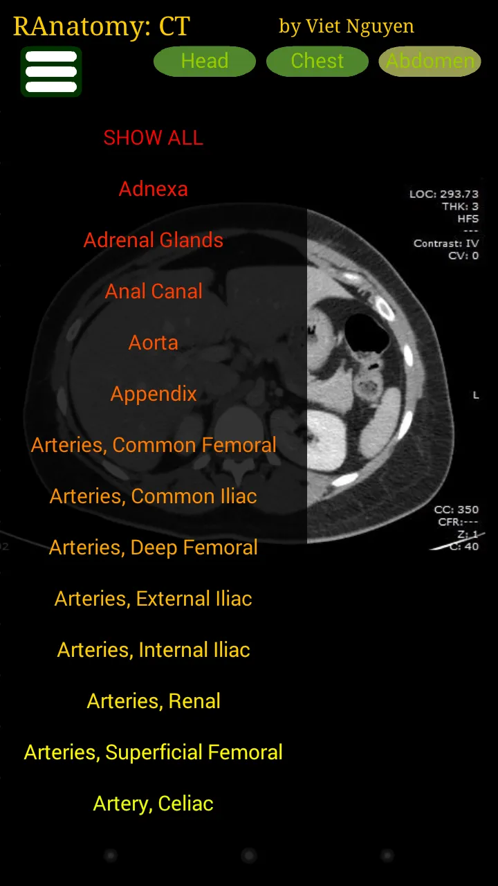 Radiology CT Anatomy | Indus Appstore | Screenshot