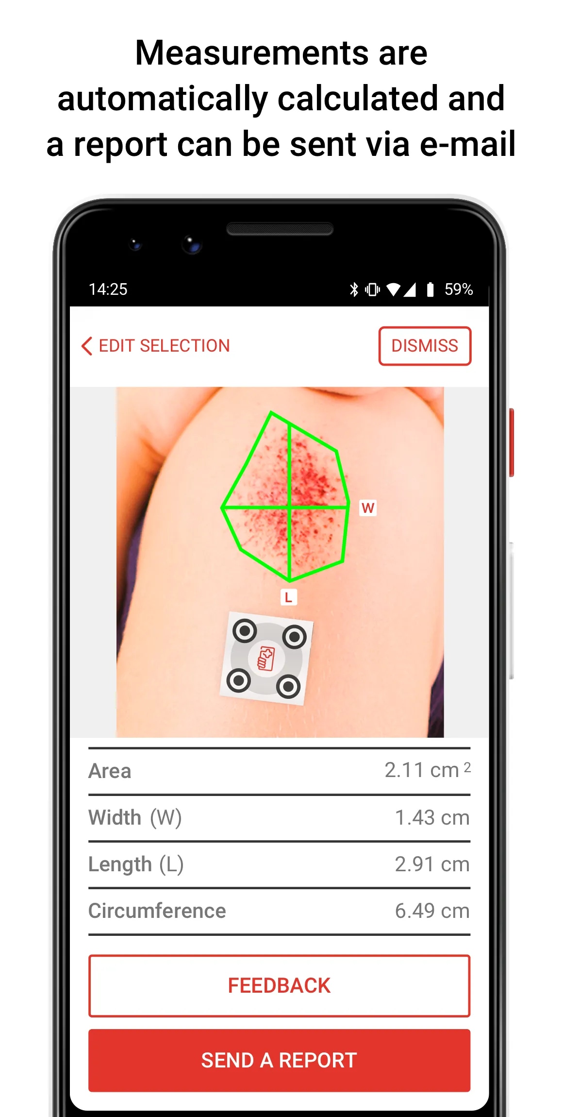 imitoMeasure - Measure Wounds | Indus Appstore | Screenshot