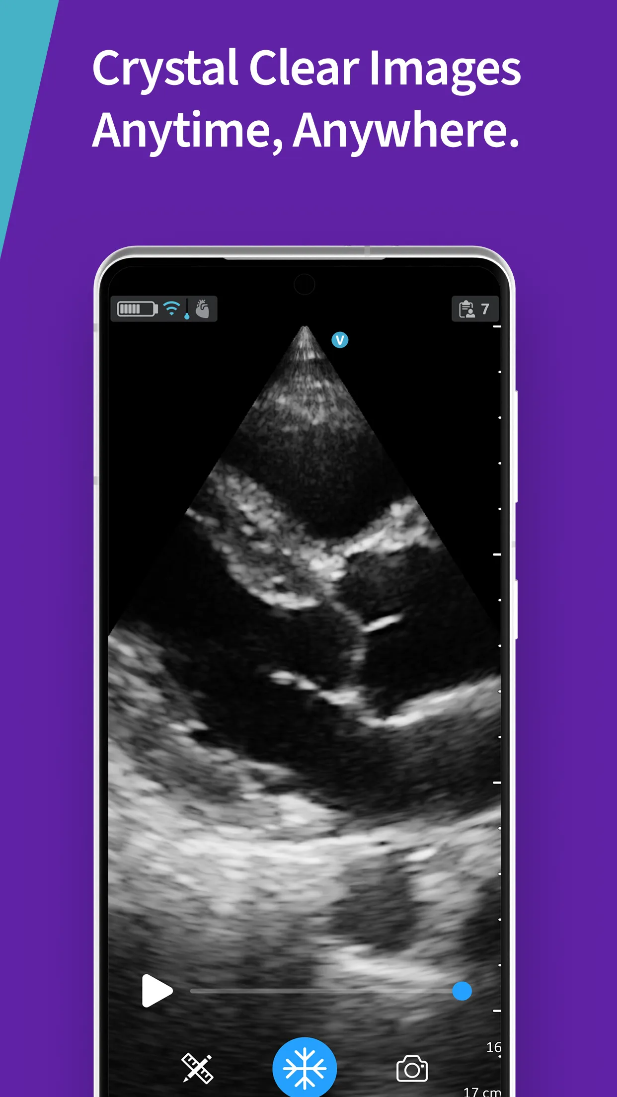 Vscan Air Wireless Ultrasound | Indus Appstore | Screenshot