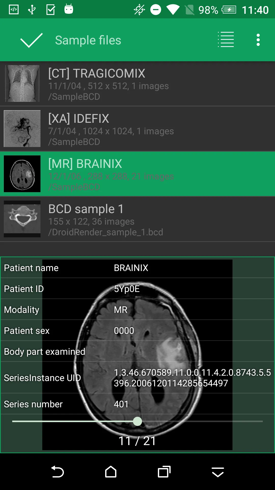 DroidRender - 3D DICOM viewer | Indus Appstore | Screenshot