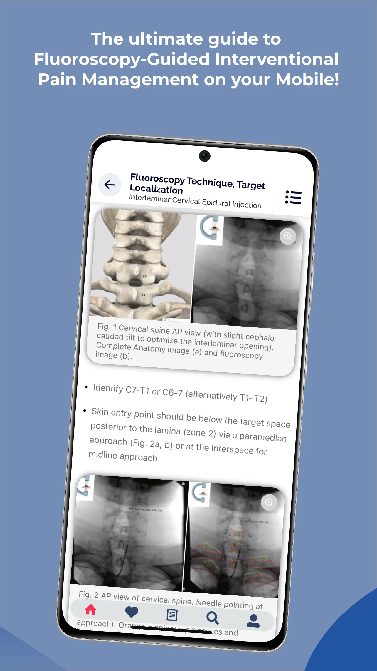 Interventional Pain App | Indus Appstore | Screenshot