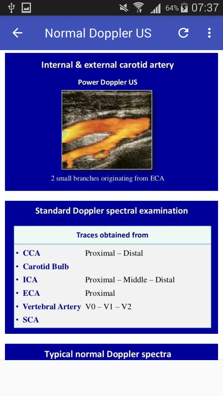 Doppler US Of Carotid arteries | Indus Appstore | Screenshot