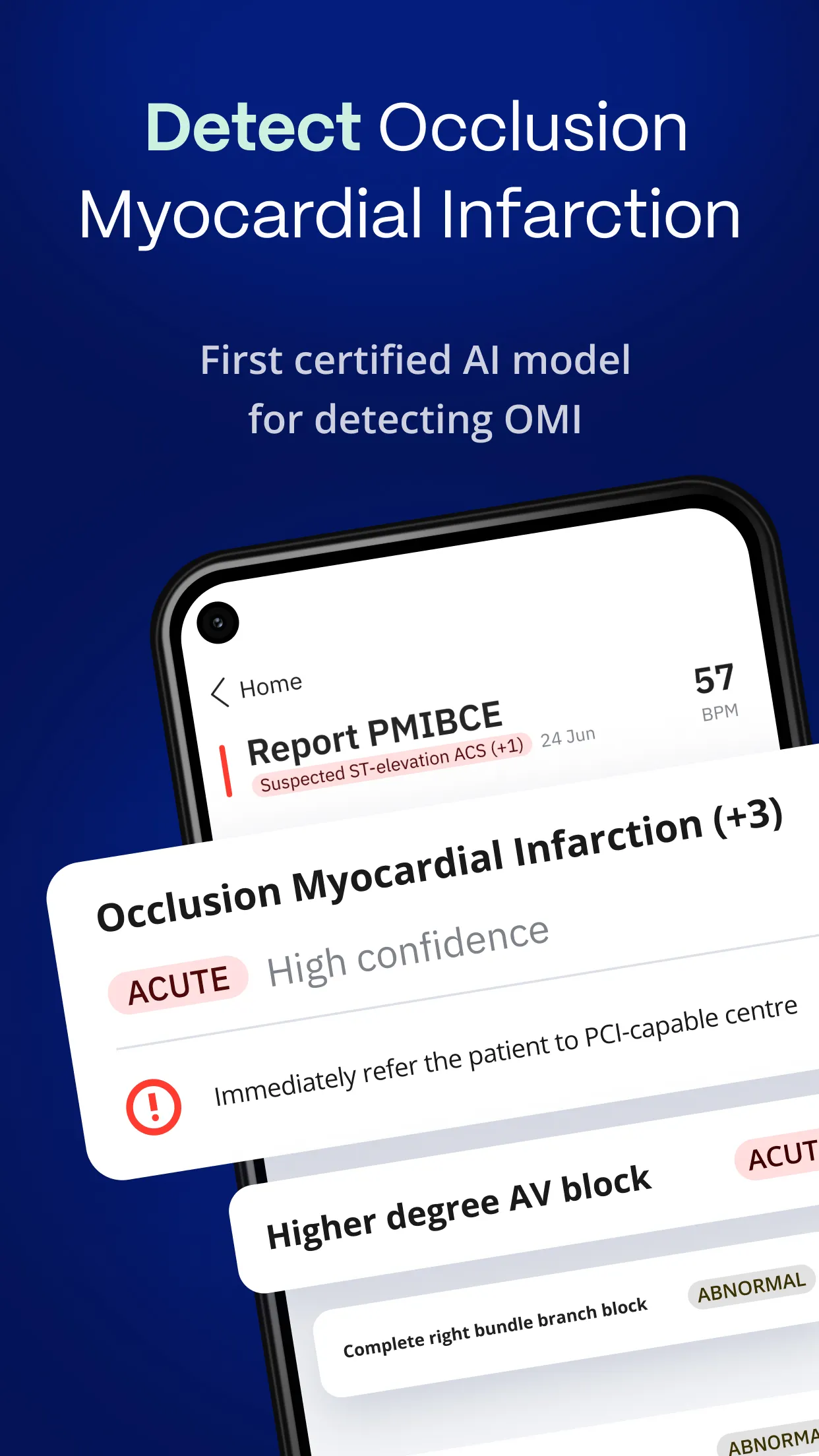 PMcardio - ECG Analysis | Indus Appstore | Screenshot