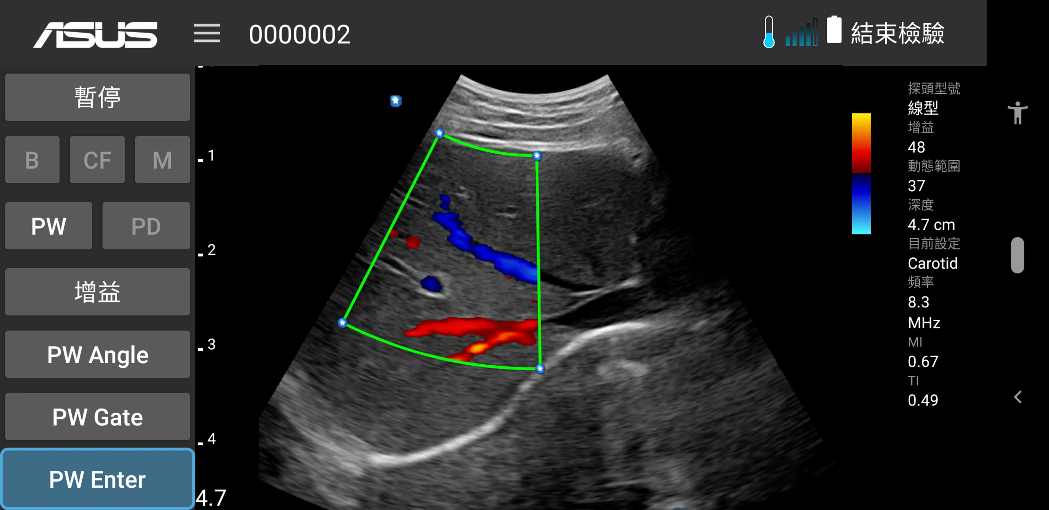 MediConnect – ASUS Ultrasound | Indus Appstore | Screenshot