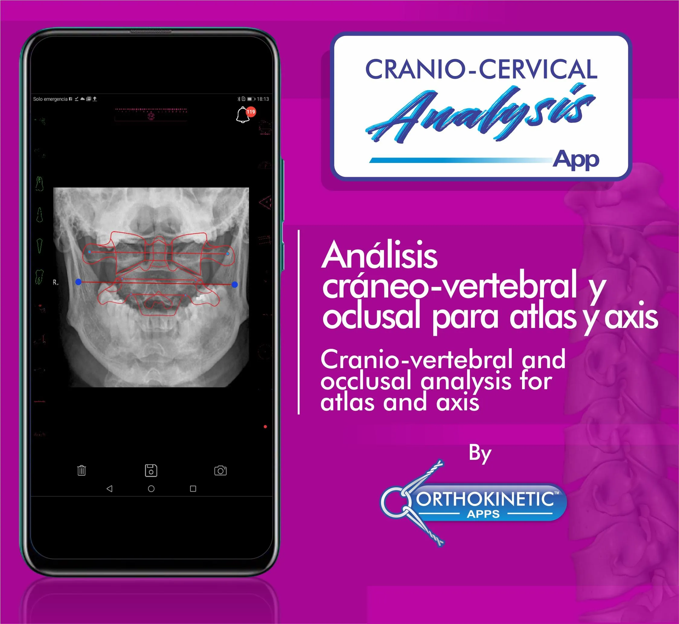 Cranio-cervical Analysis by Or | Indus Appstore | Screenshot