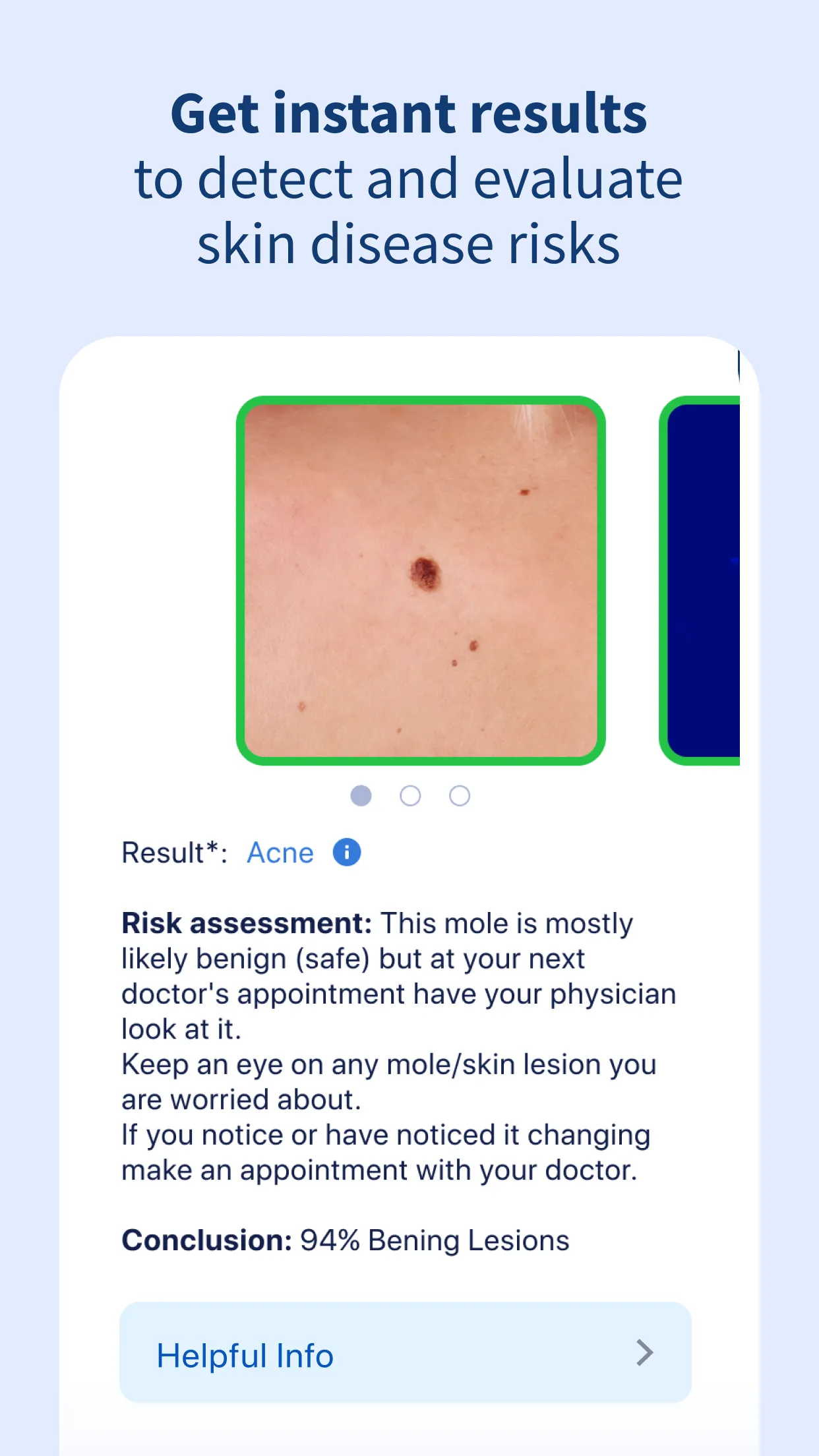 AI Dermatologist: Skin Scanner | Indus Appstore | Screenshot