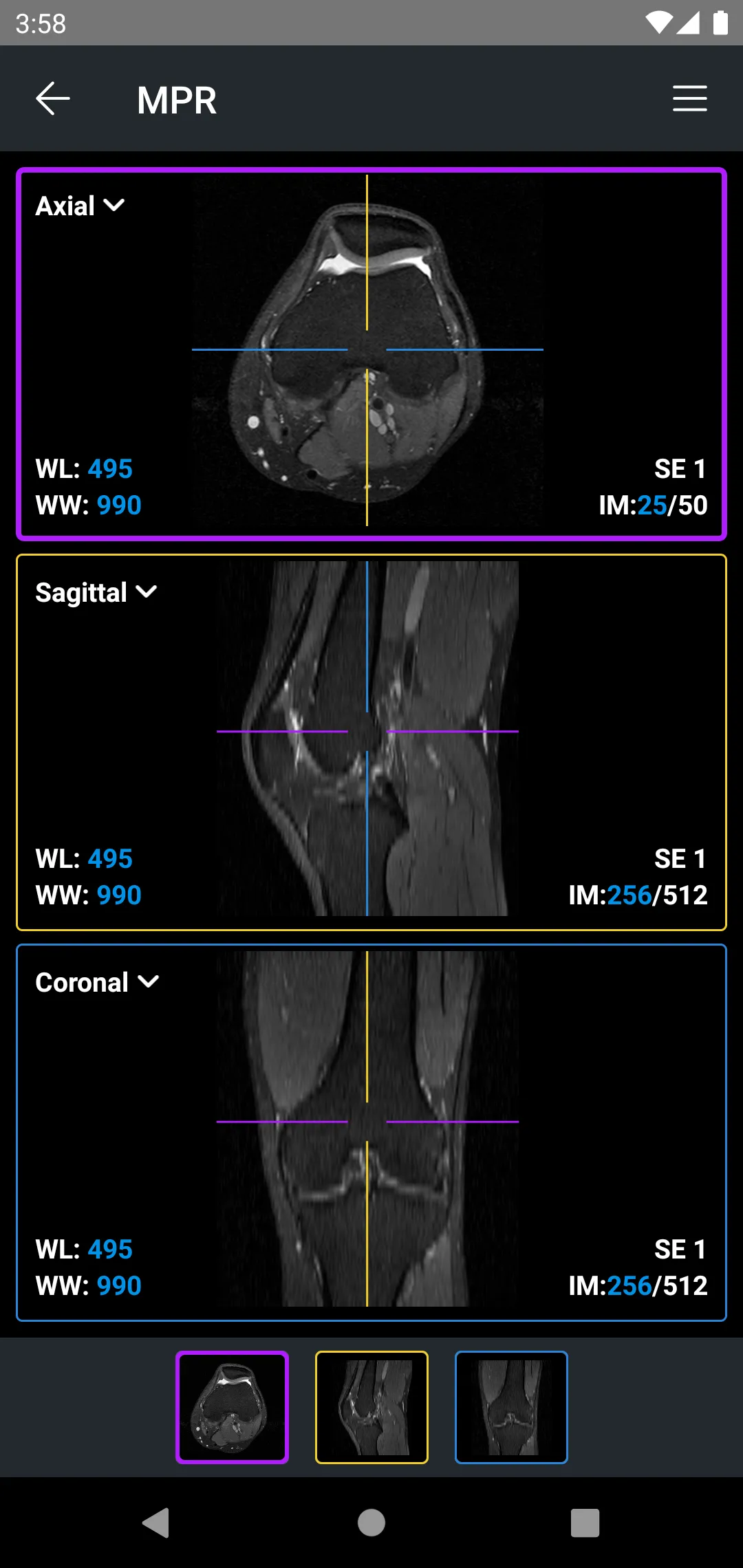 IDV - IMAIOS DICOM Viewer | Indus Appstore | Screenshot