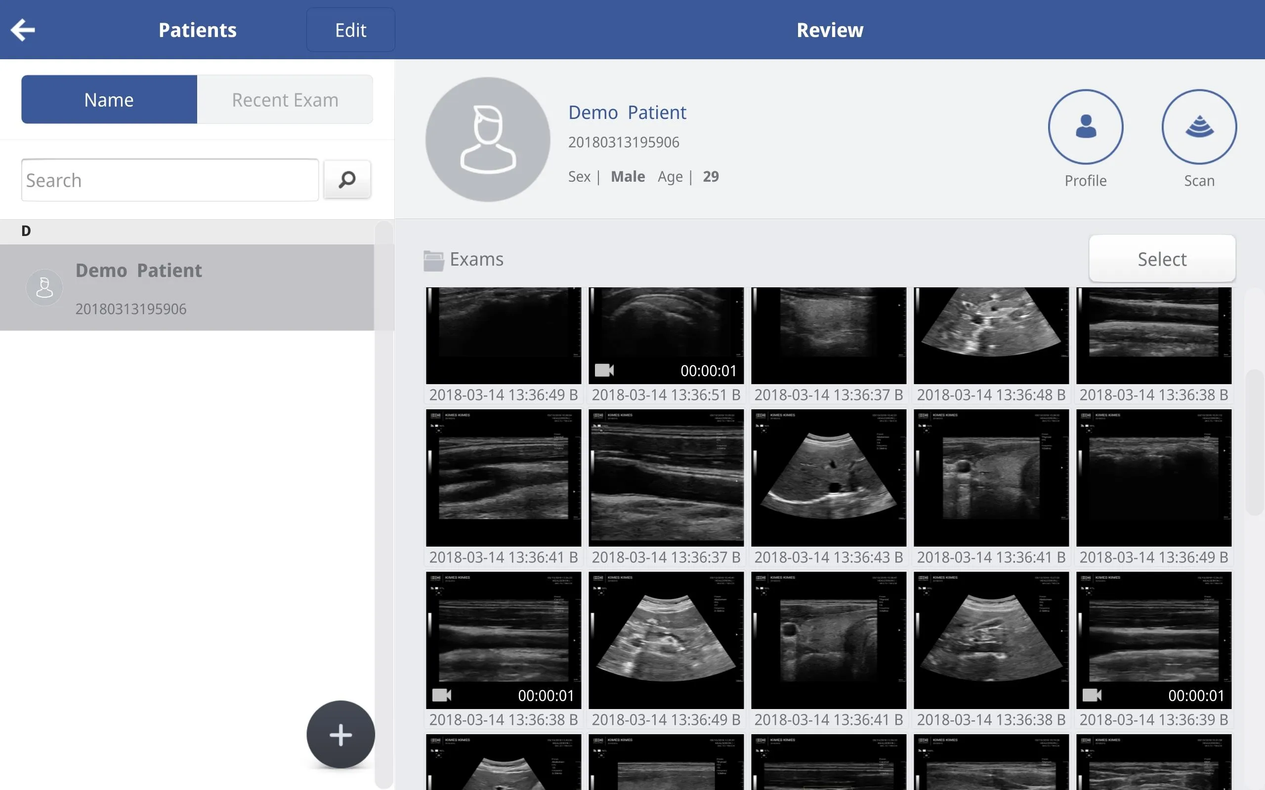 SONON X Ultrasound App | Indus Appstore | Screenshot