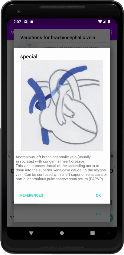 Vascular Variants | Indus Appstore | Screenshot