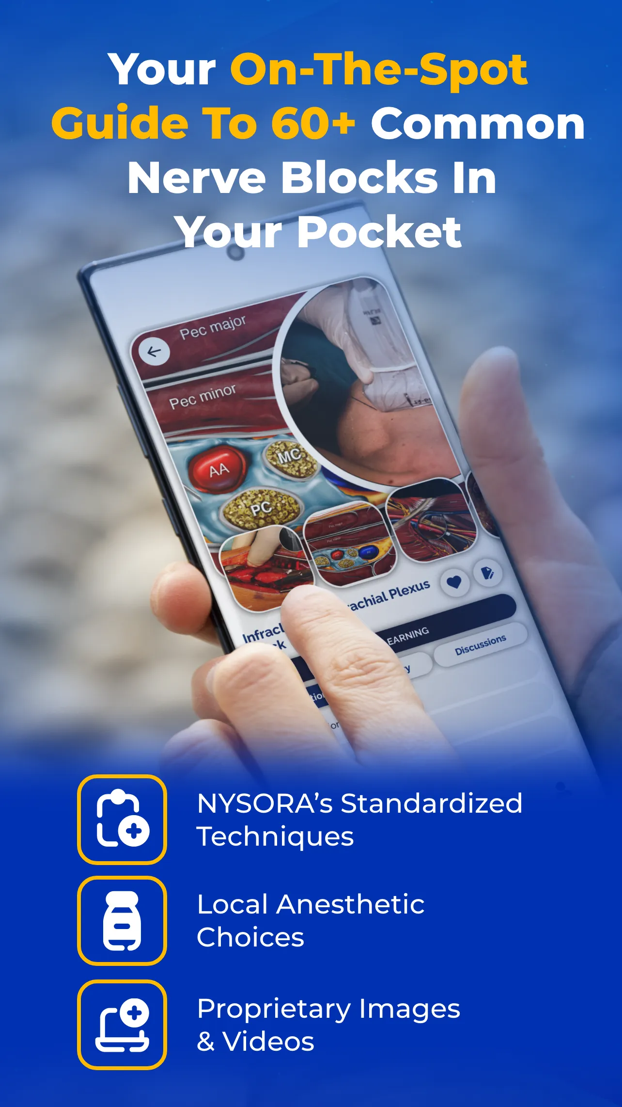 NYSORA Nerve Blocks | Indus Appstore | Screenshot
