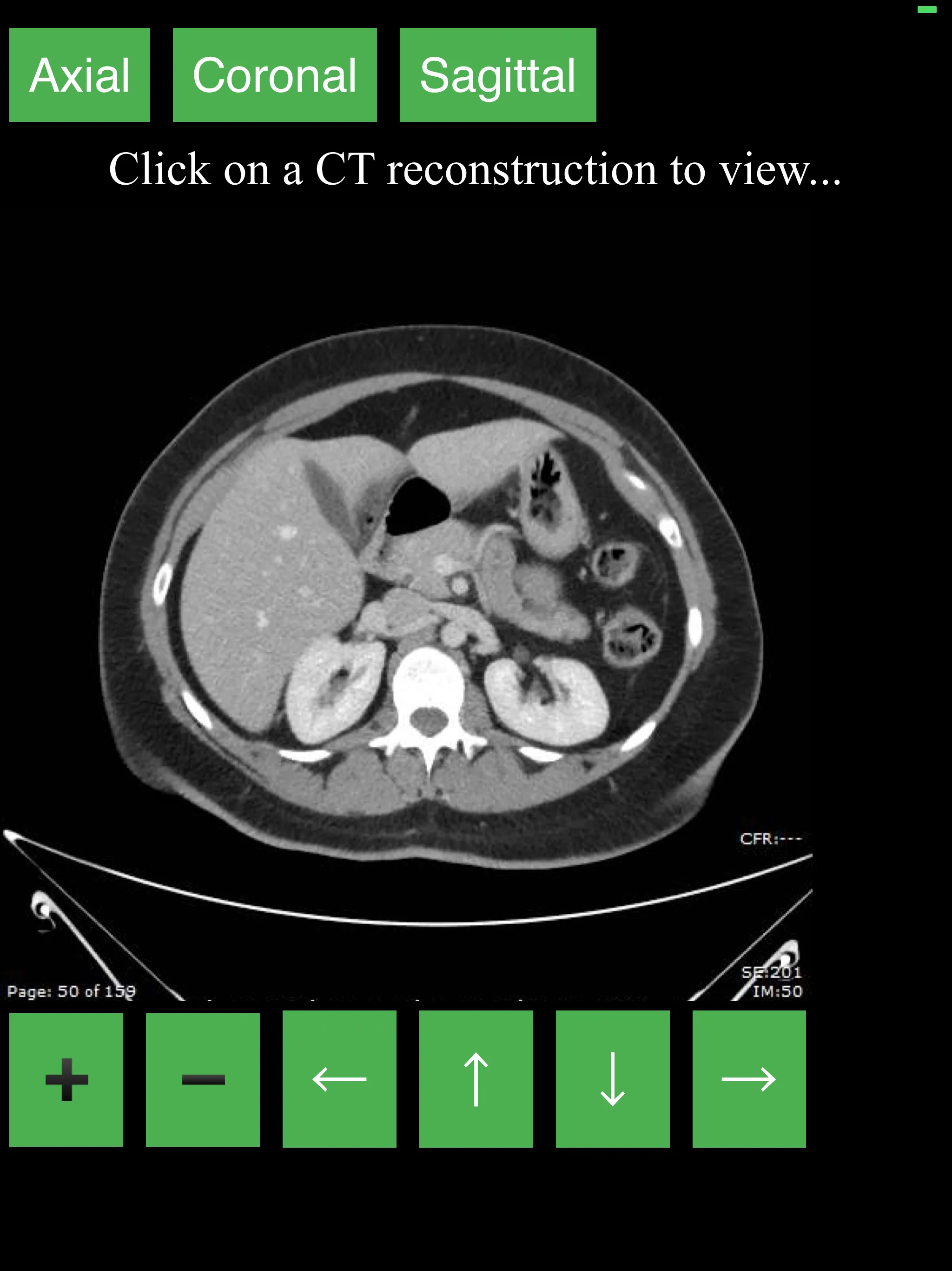 CT Abdomen Pelvis | Indus Appstore | Screenshot