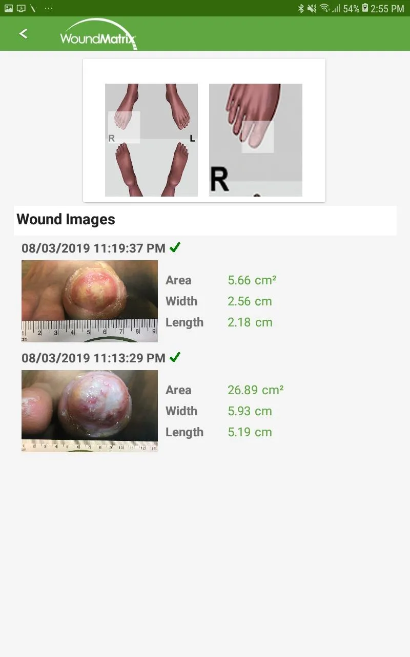 WoundMatrix Patient | Indus Appstore | Screenshot