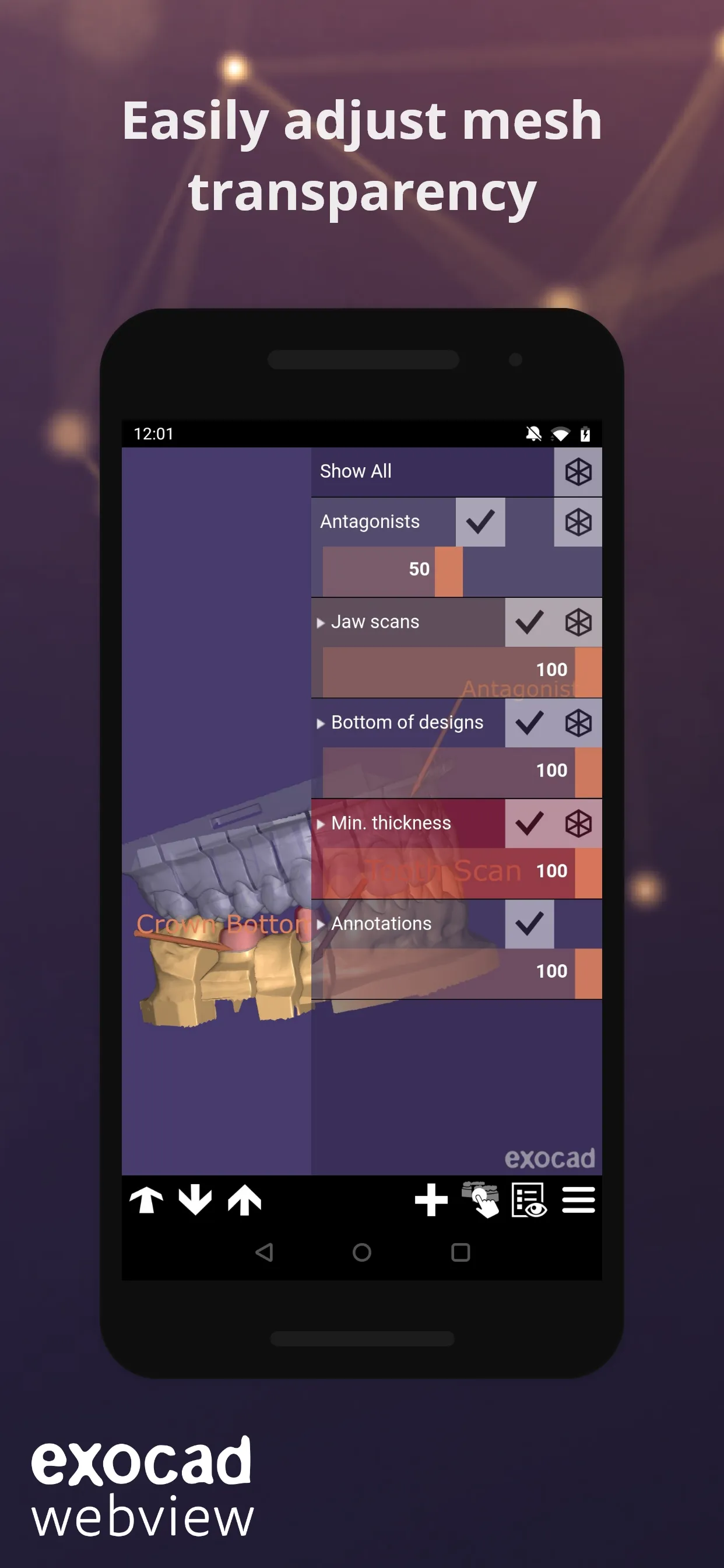 exocad webview - STL 3D Viewer | Indus Appstore | Screenshot