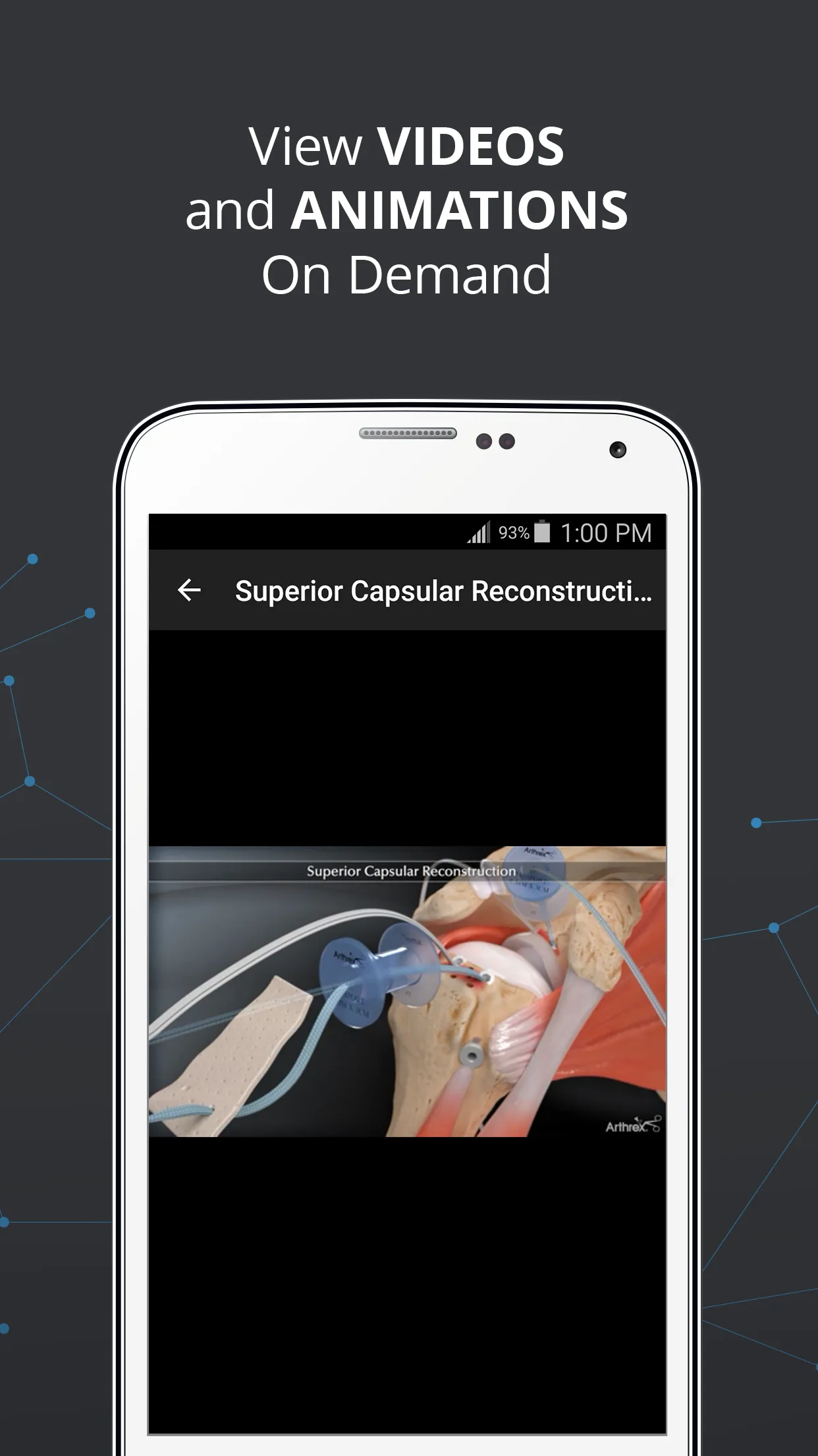 Arthrex Surgeon App | Indus Appstore | Screenshot