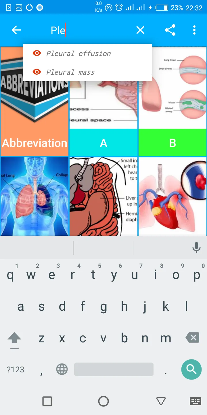 A-Z Chest XRay Pathology Guide | Indus Appstore | Screenshot