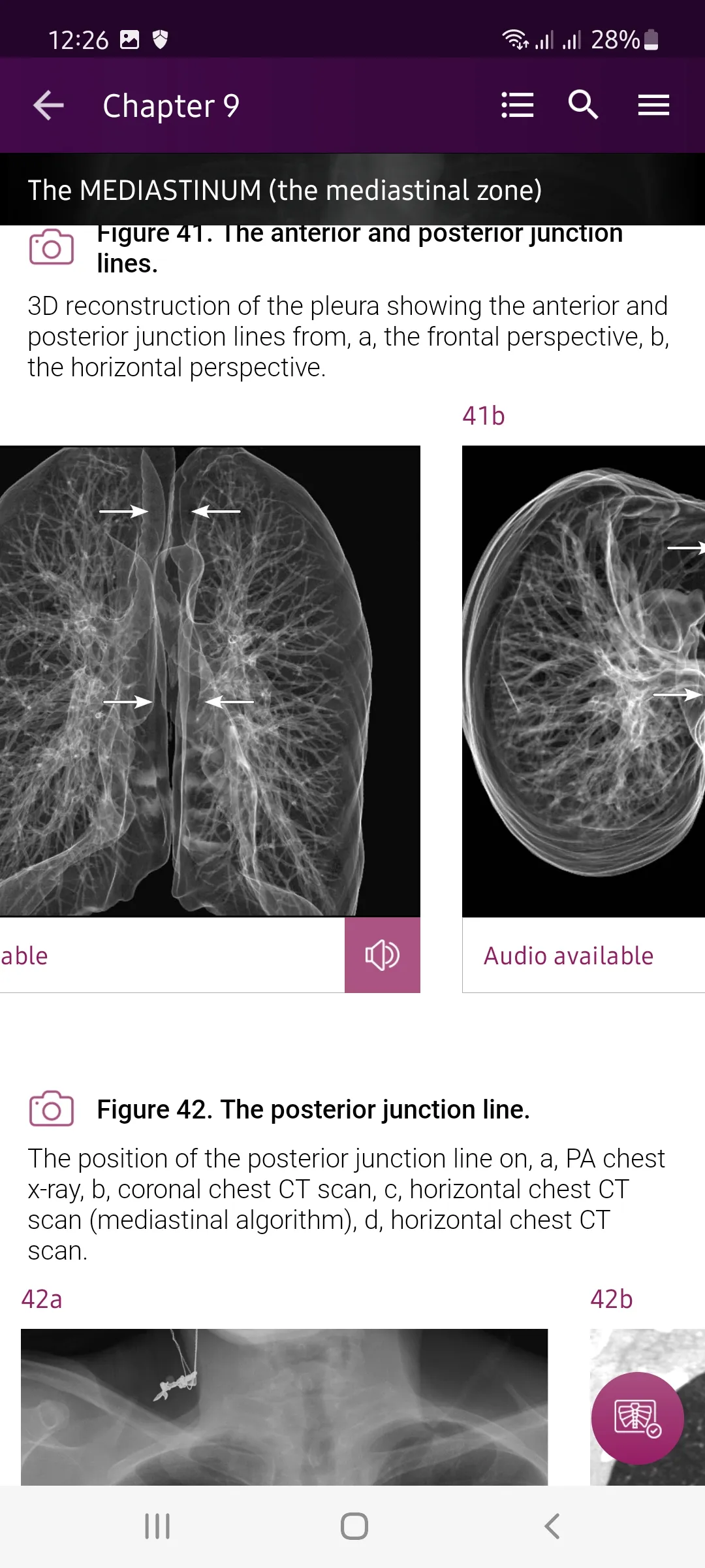 Chest X-Ray DEMO | Indus Appstore | Screenshot