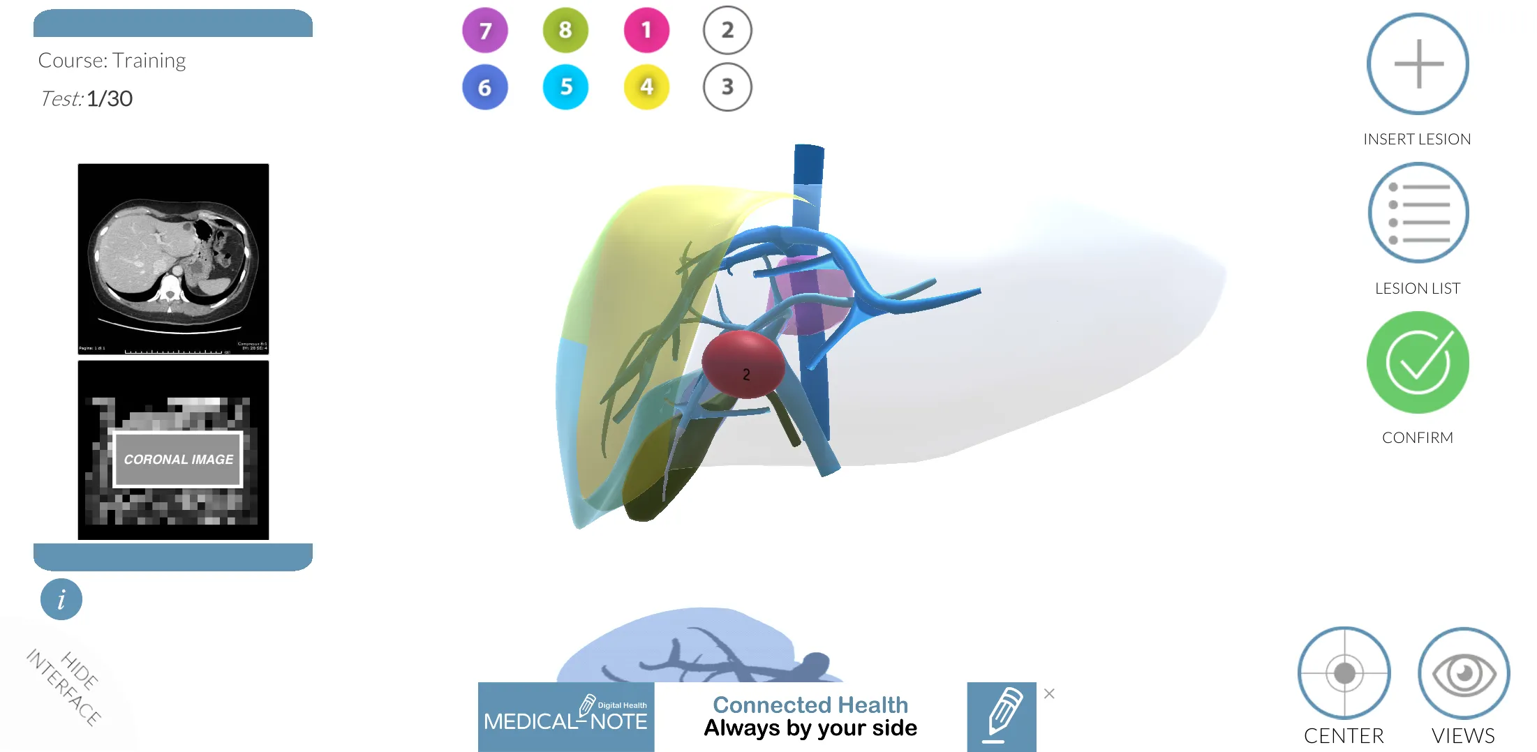 LIVER-NOTE.Edu | Indus Appstore | Screenshot