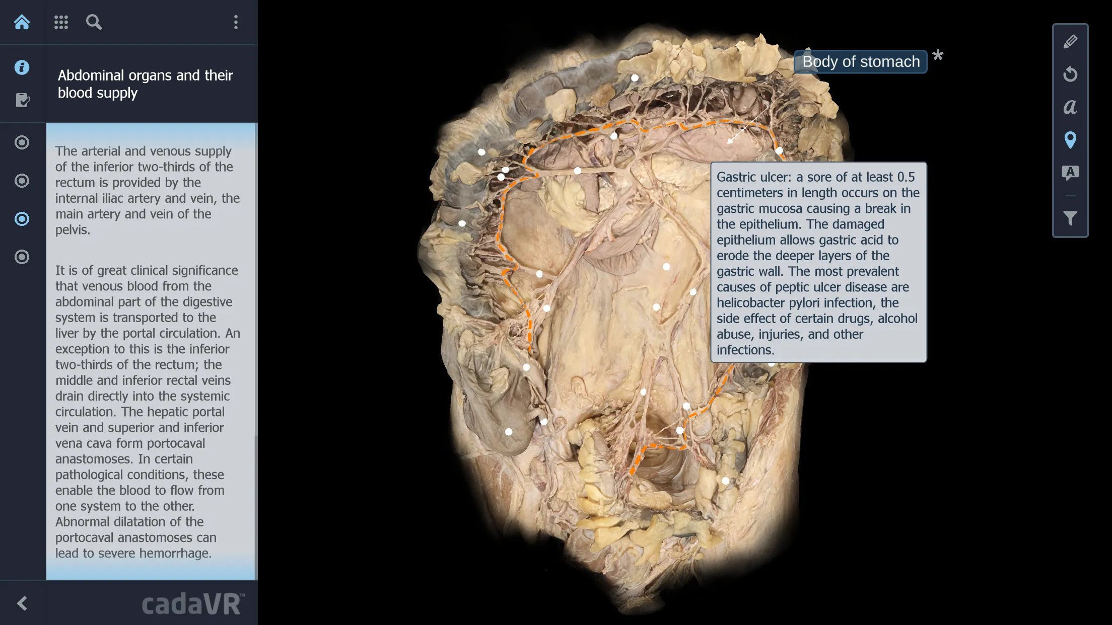 cadaVR anatomy | Indus Appstore | Screenshot