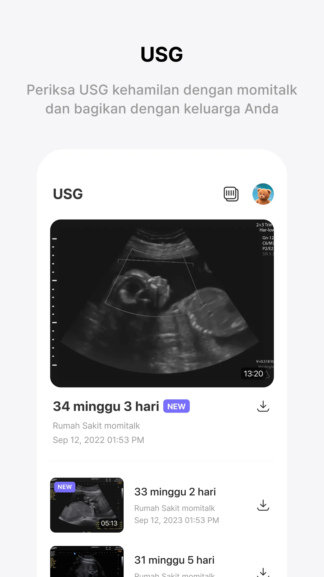 Momitalk: Pregnancy Ultrasound | Indus Appstore | Screenshot