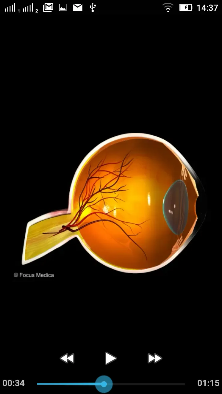 Ophthalmology -Pocket Dict. | Indus Appstore | Screenshot