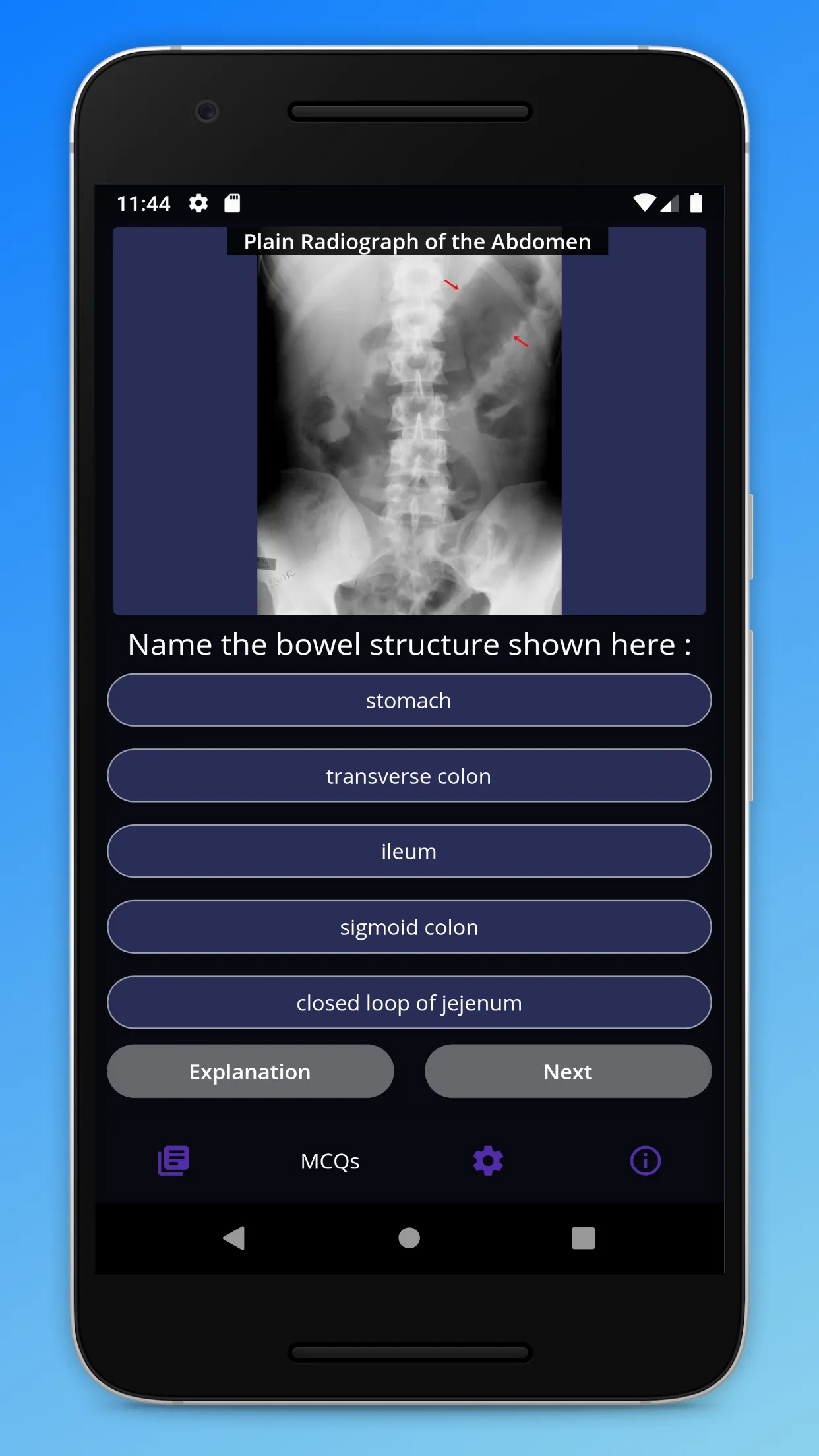 Basic Radiology | Indus Appstore | Screenshot