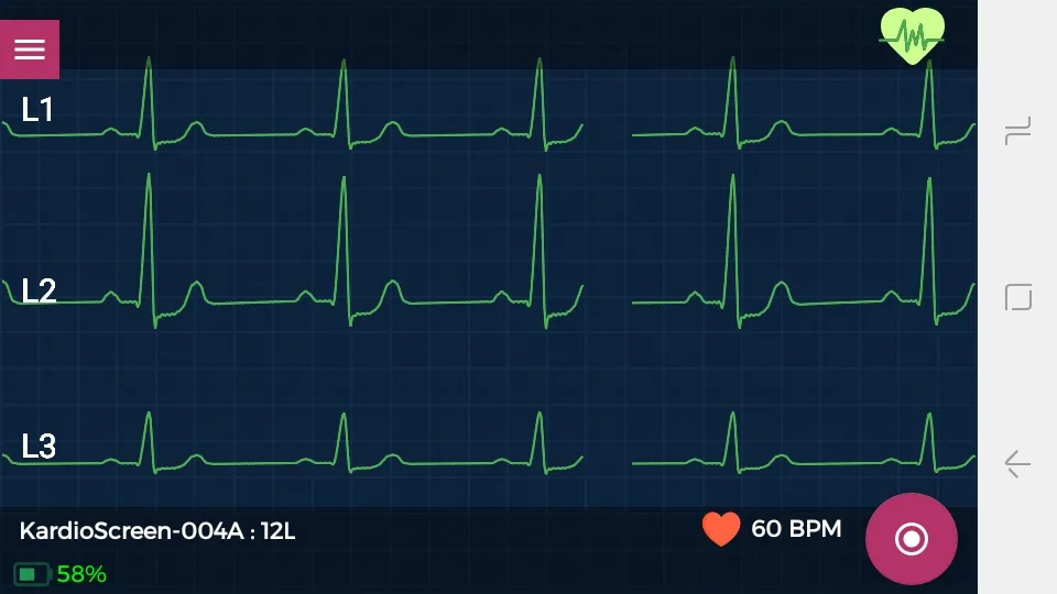 KardioScreen | Indus Appstore | Screenshot